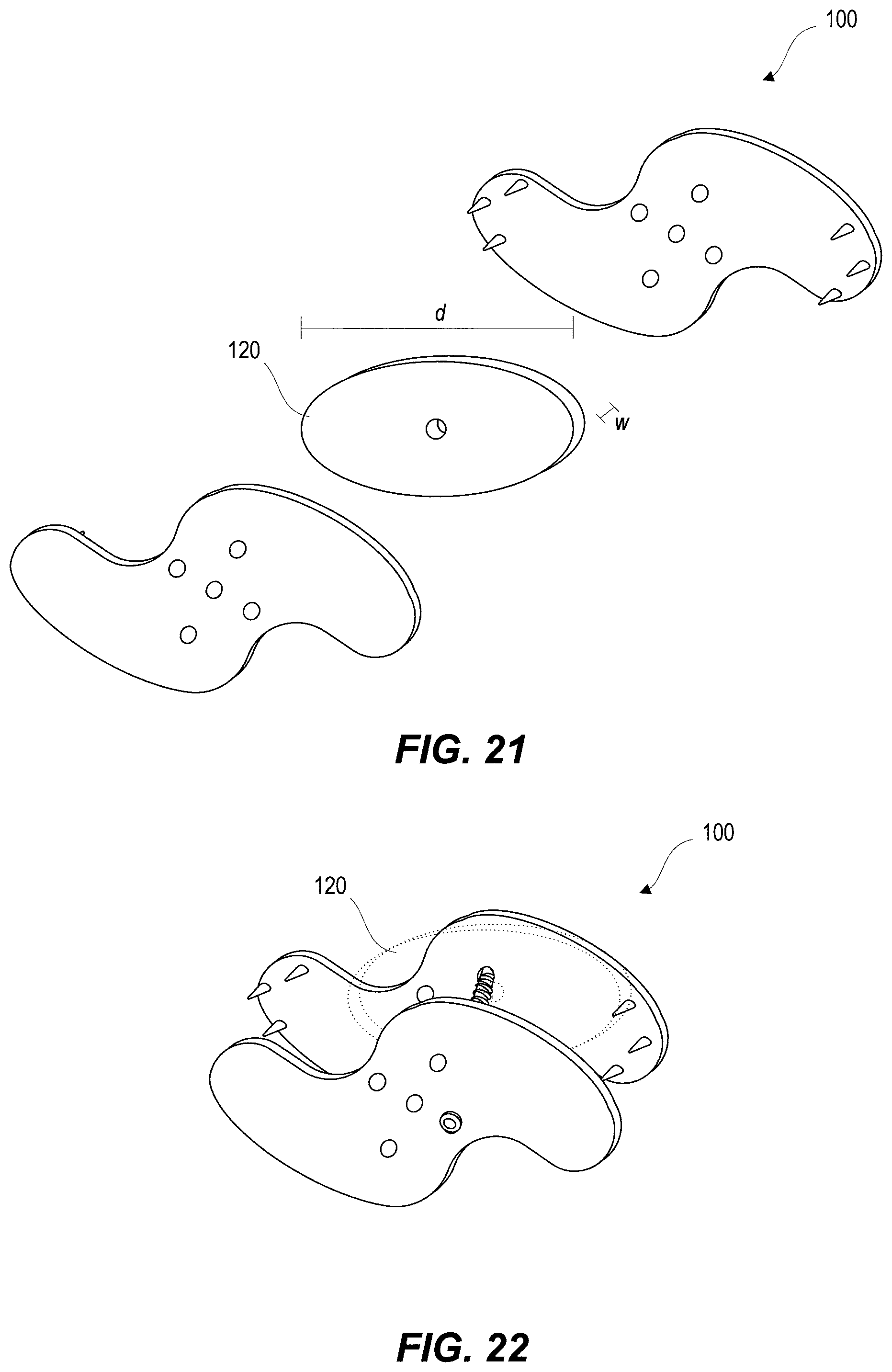 Patent US11812923 Figure 11 – Spinal fixation device