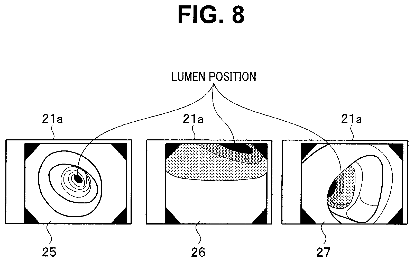 Patent US11812925 Figure 5 – Movement assistance system and movement assistance method for controlling output of position estimation result