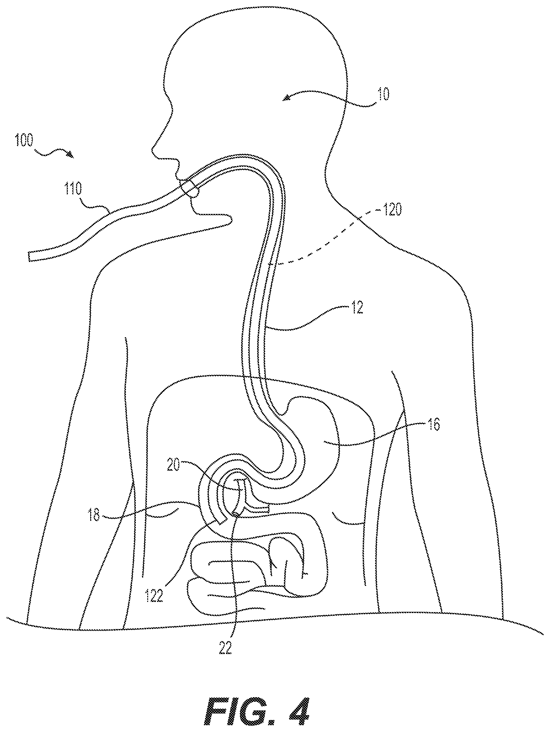 Patent US11812926 Figure 3 – Medical device tracking systems and methods of using the same