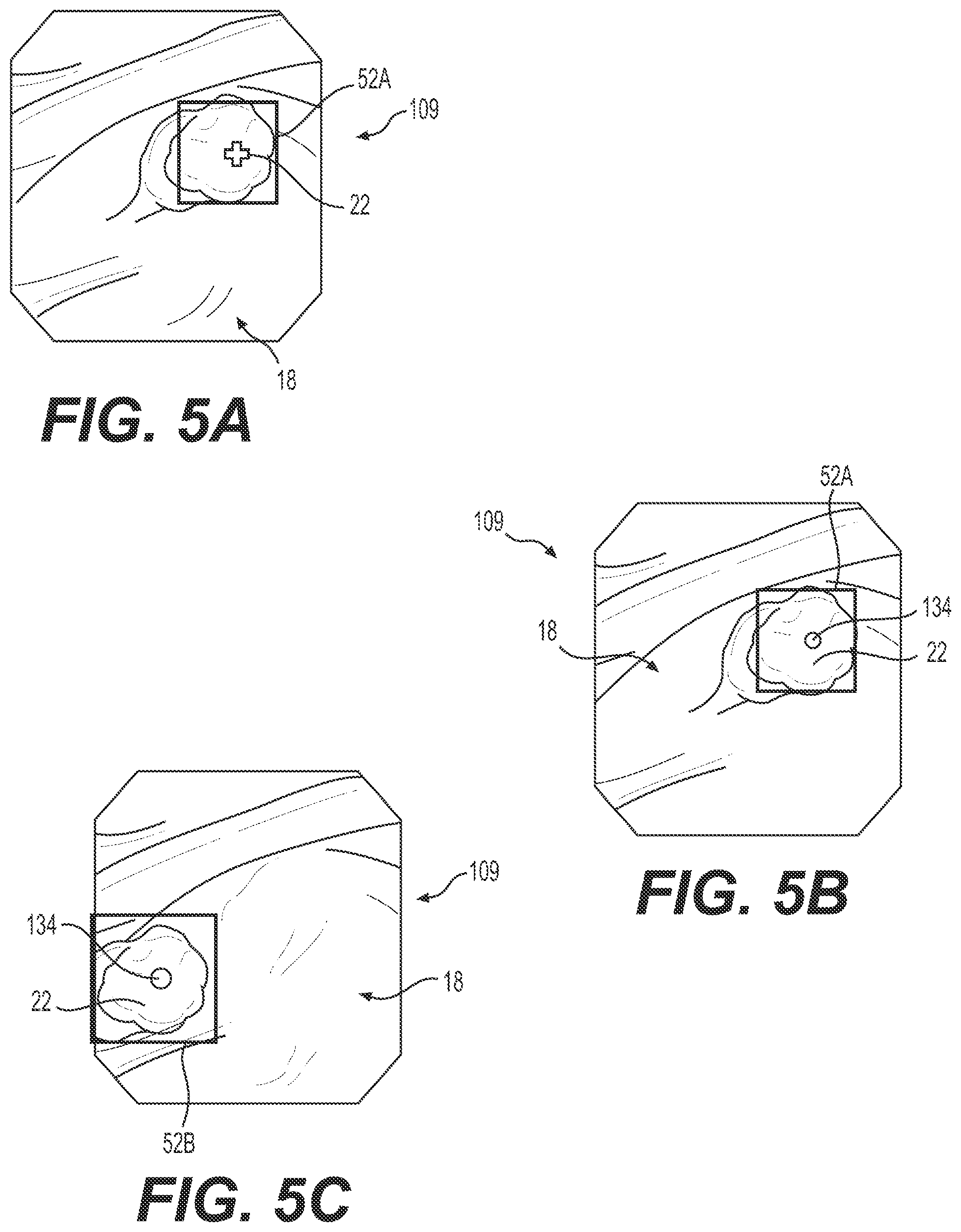 Patent US11812926 Figure 4 – Medical device tracking systems and methods of using the same