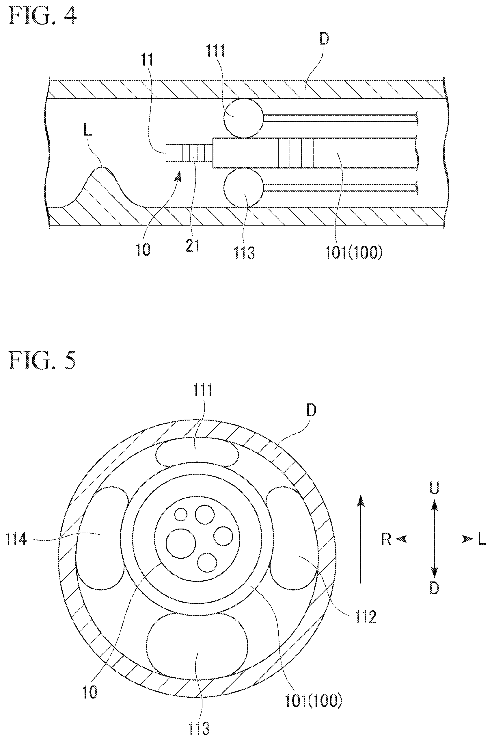 Patent US11812931 Figure 3 – Overtube system and operation method of the same