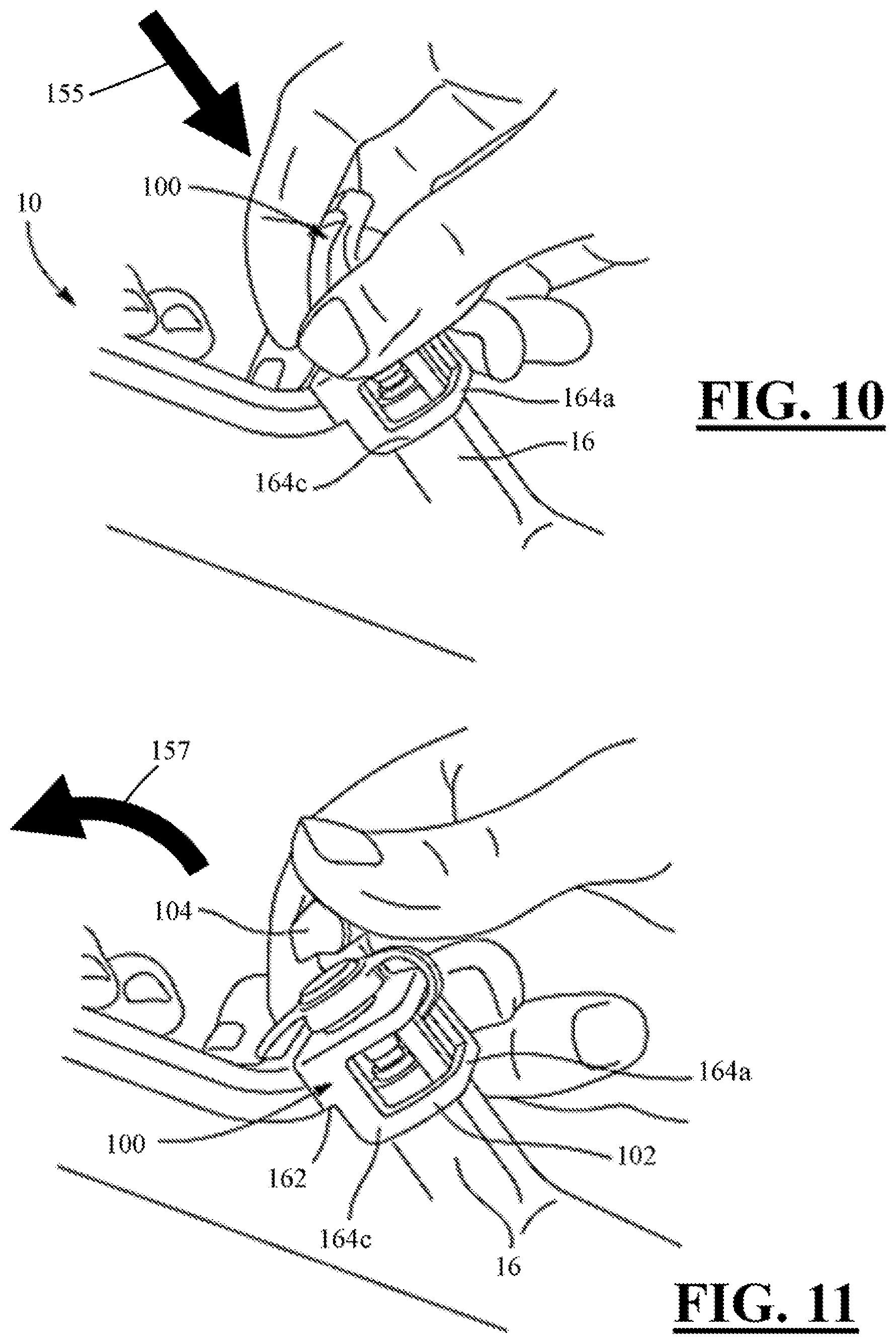 Patent US11812932 Figure 5 – Guidewire locking device