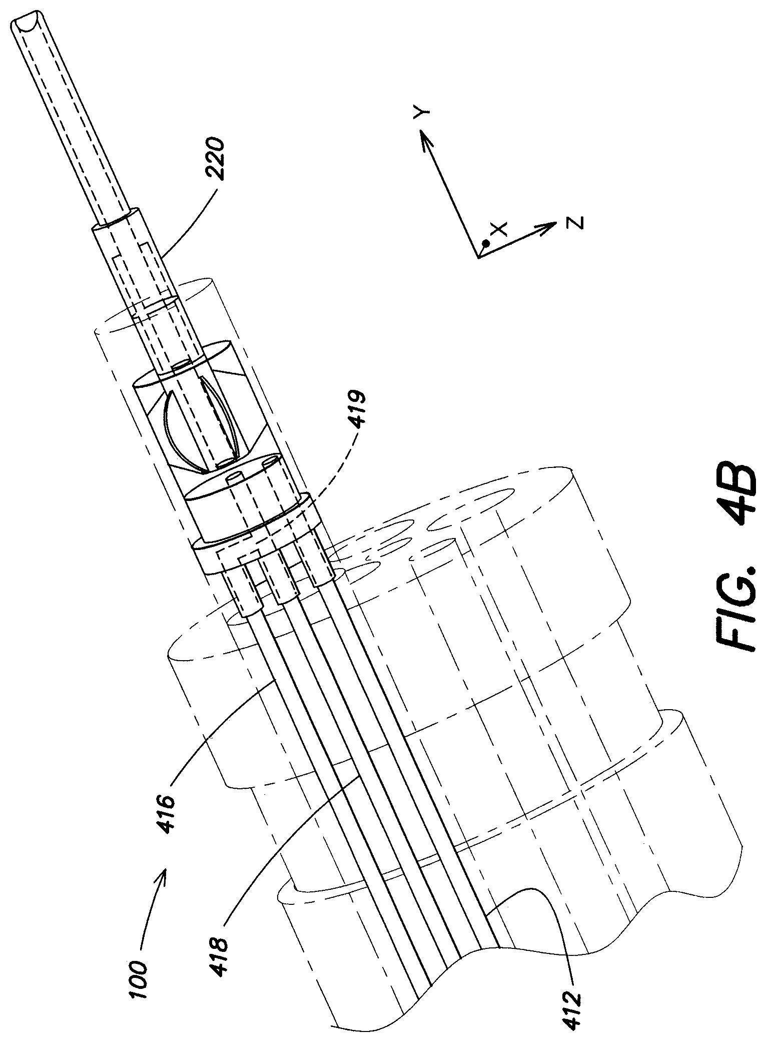 Patent US11812933 Figure 5 – Endoscopic tool for deb riding and removing polyps