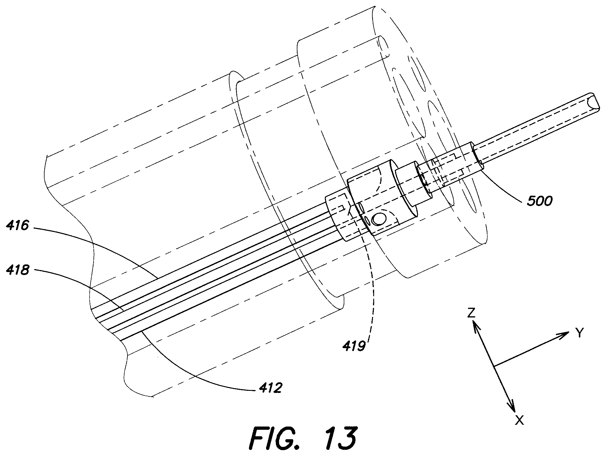 Patent US11812933 Figure 14 – Endoscopic tool for deb riding and removing polyps
