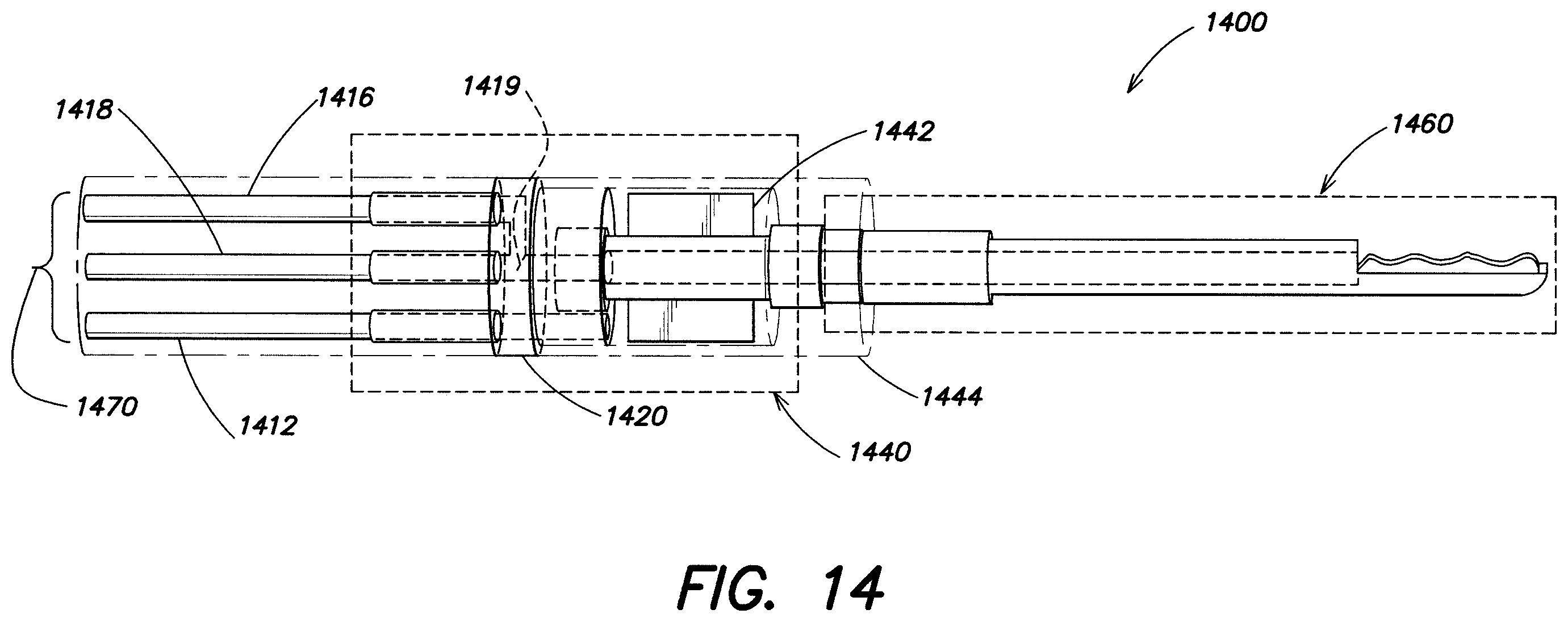 Patent US11812933 Figure 15 – Endoscopic tool for deb riding and removing polyps