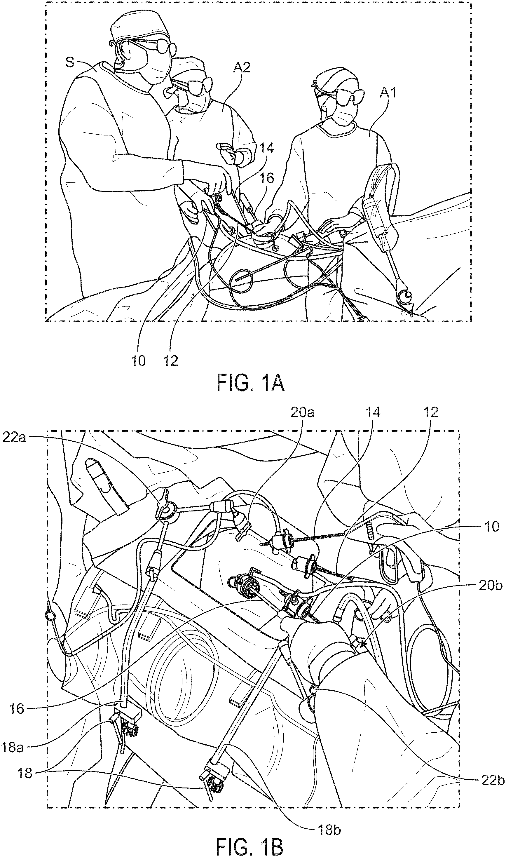 Patent US11812938 Figure 1 – Co-manipulation surgical system having a coupling mechanism removeably attachable to surgical instruments