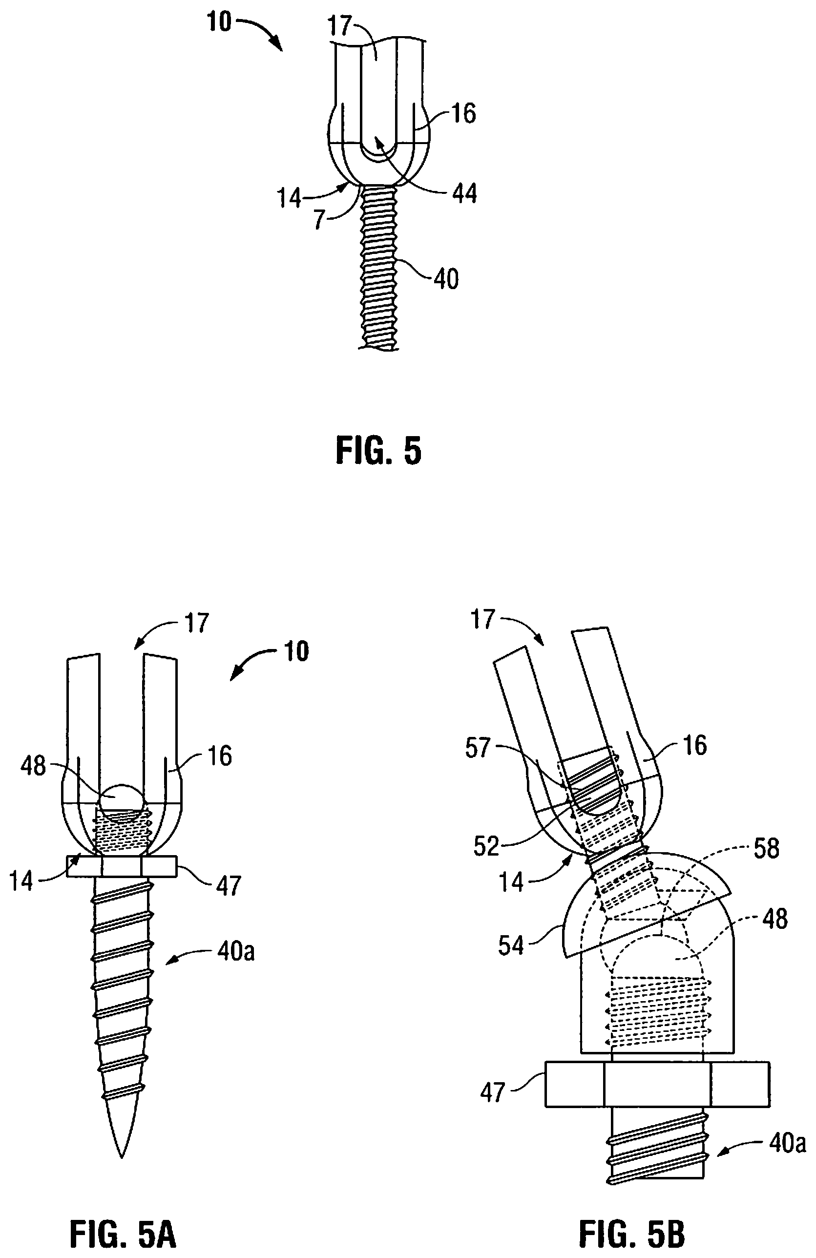 Patent US11812940 Figure 3 – Minimally open interbody access retraction device and surgical method
