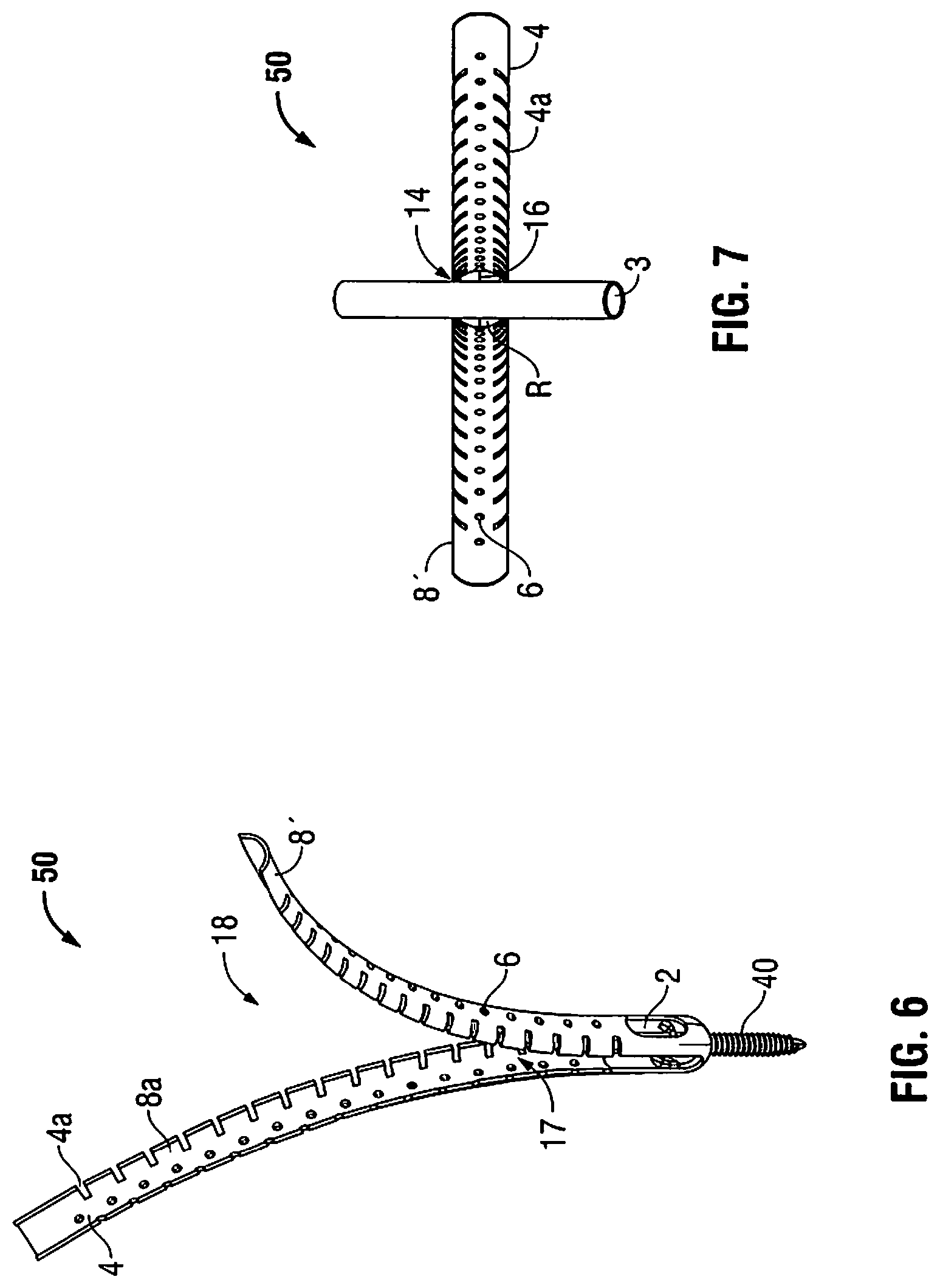 Patent US11812940 Figure 4 – Minimally open interbody access retraction device and surgical method