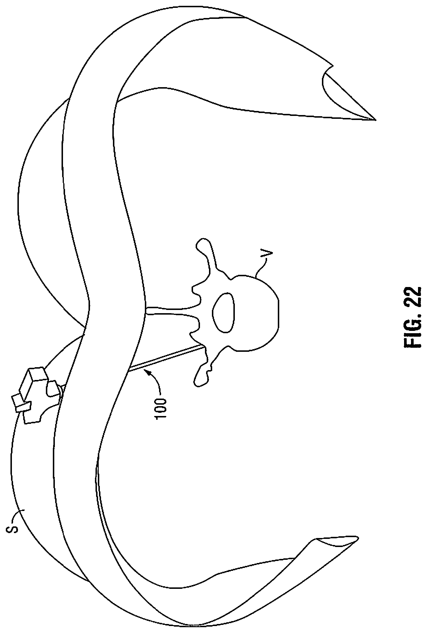 Patent US11812940 Figure 19 – Minimally open interbody access retraction device and surgical method