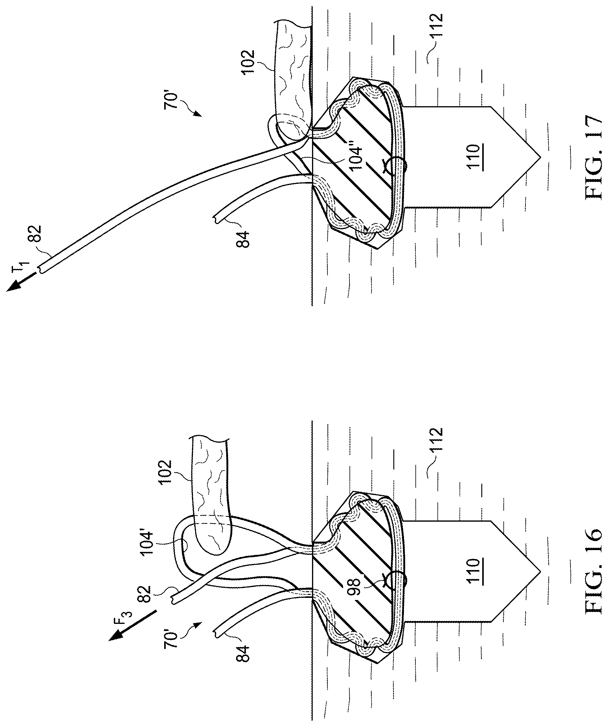 Patent US11812941 Figure 5 – Knotless all suture tissue repair