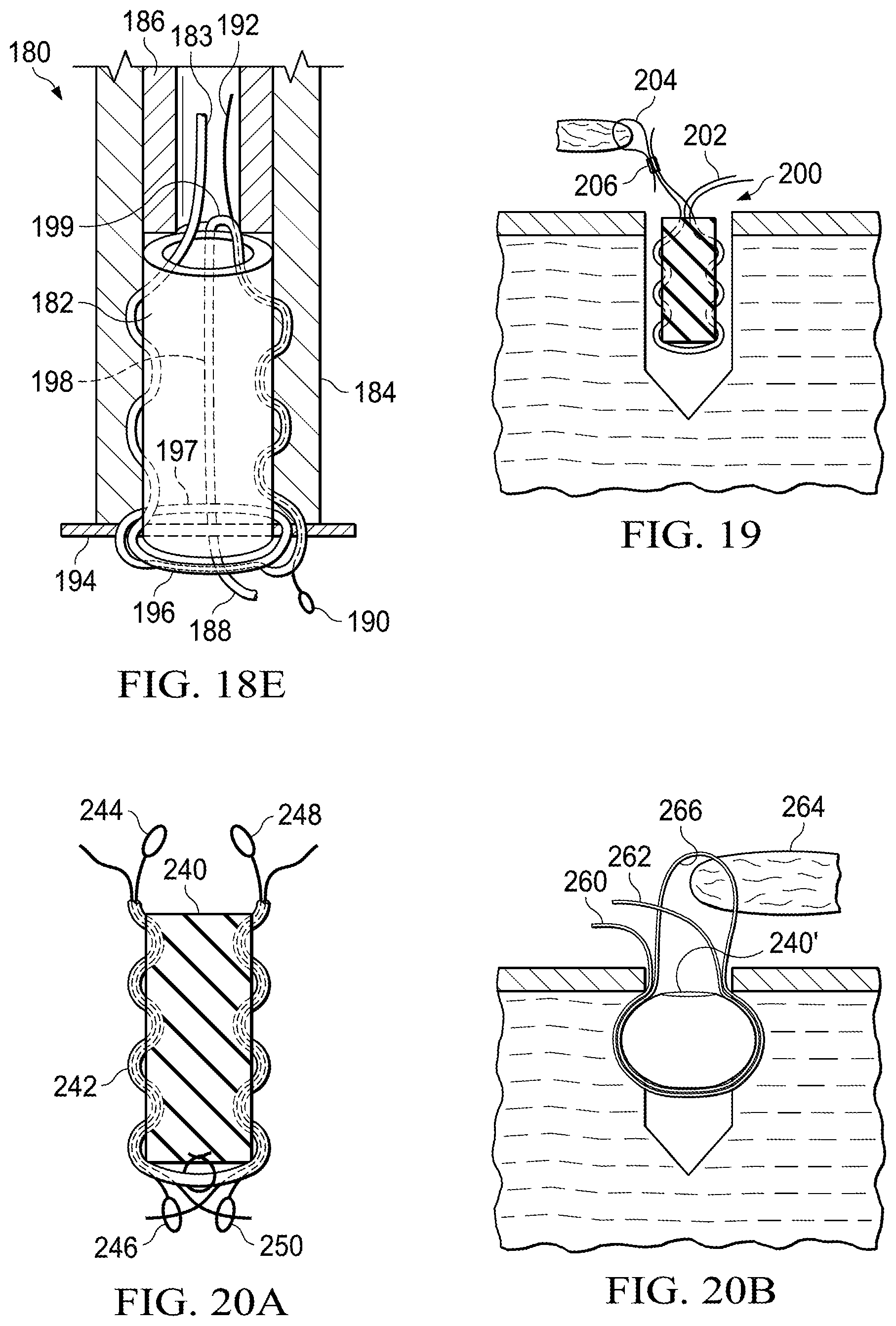 Patent US11812941 Figure 7 – Knotless all suture tissue repair
