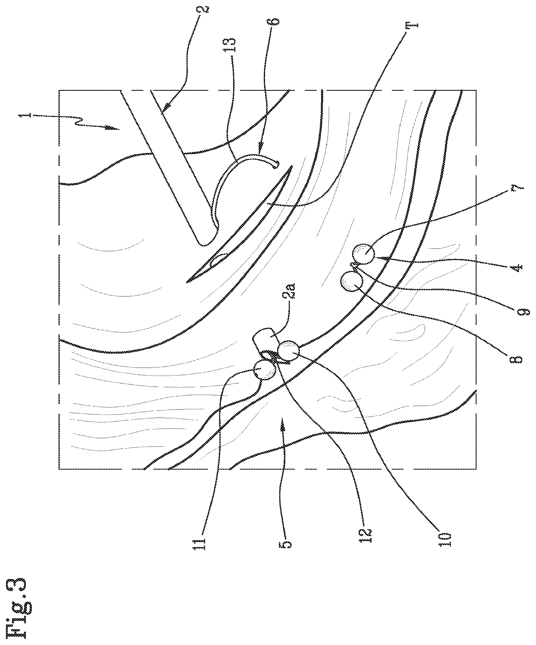 Patent US11812942 Figure 2 – Suturing device, in particular for suturing lacerations of the meniscus