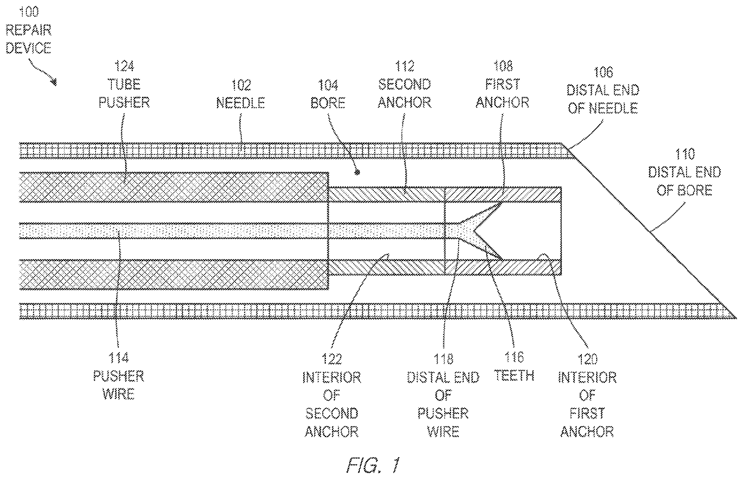Patent US11812943 Figure 1 – Repair device and method for deploying anchors
