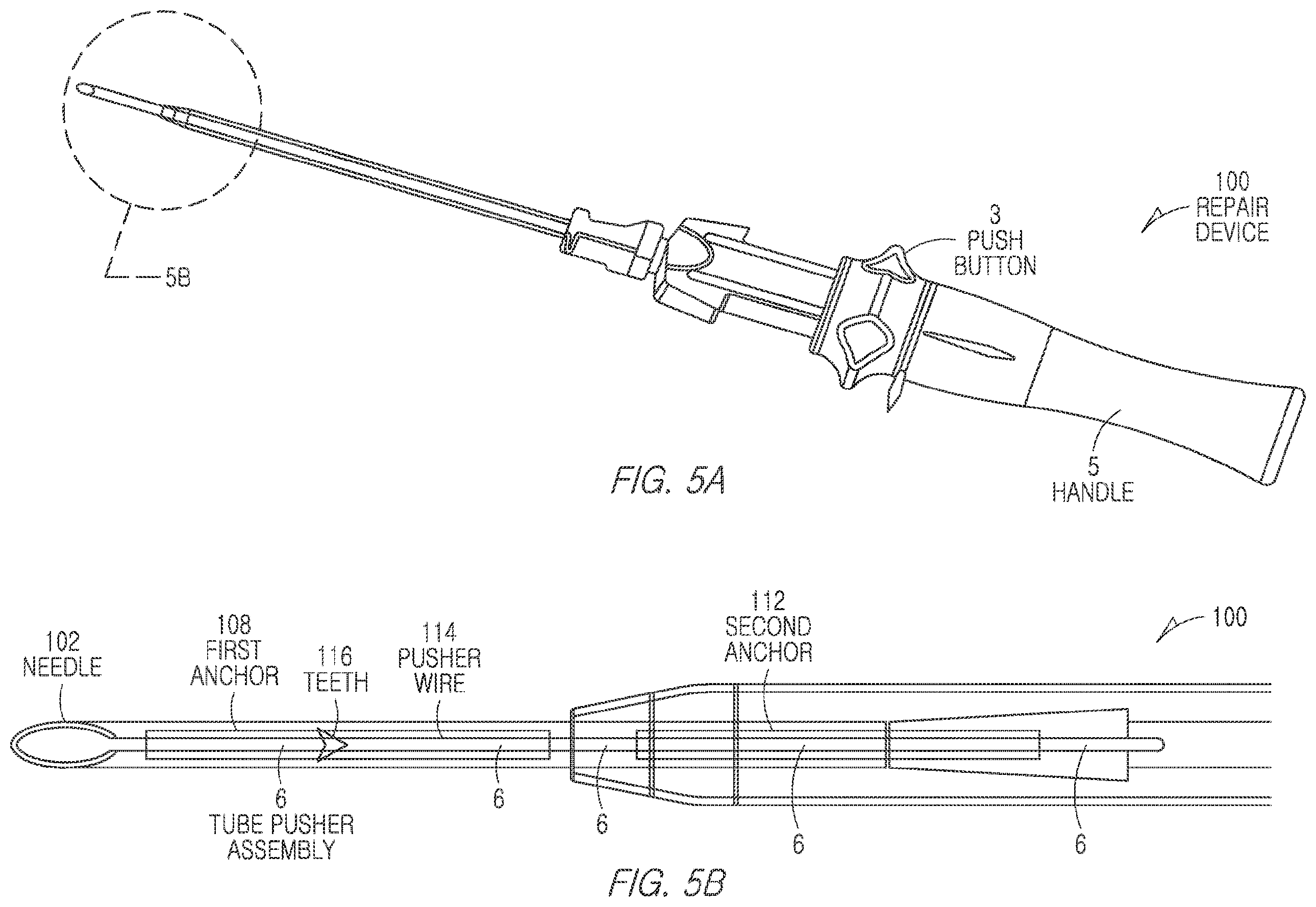 Patent US11812943 Figure 5 – Repair device and method for deploying anchors