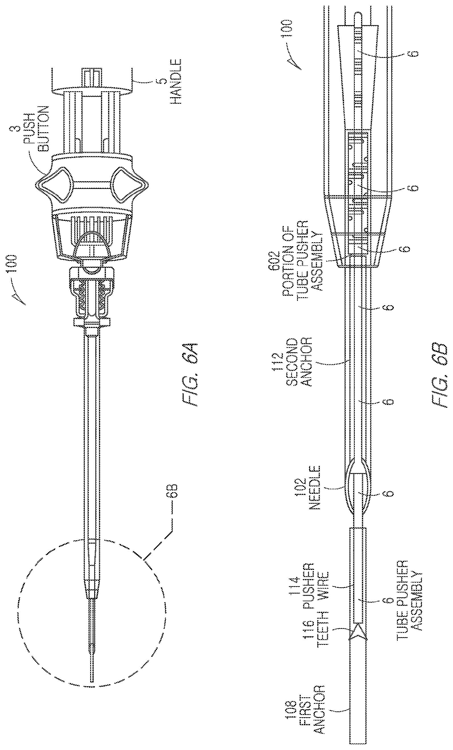 Patent US11812943 Figure 6 – Repair device and method for deploying anchors