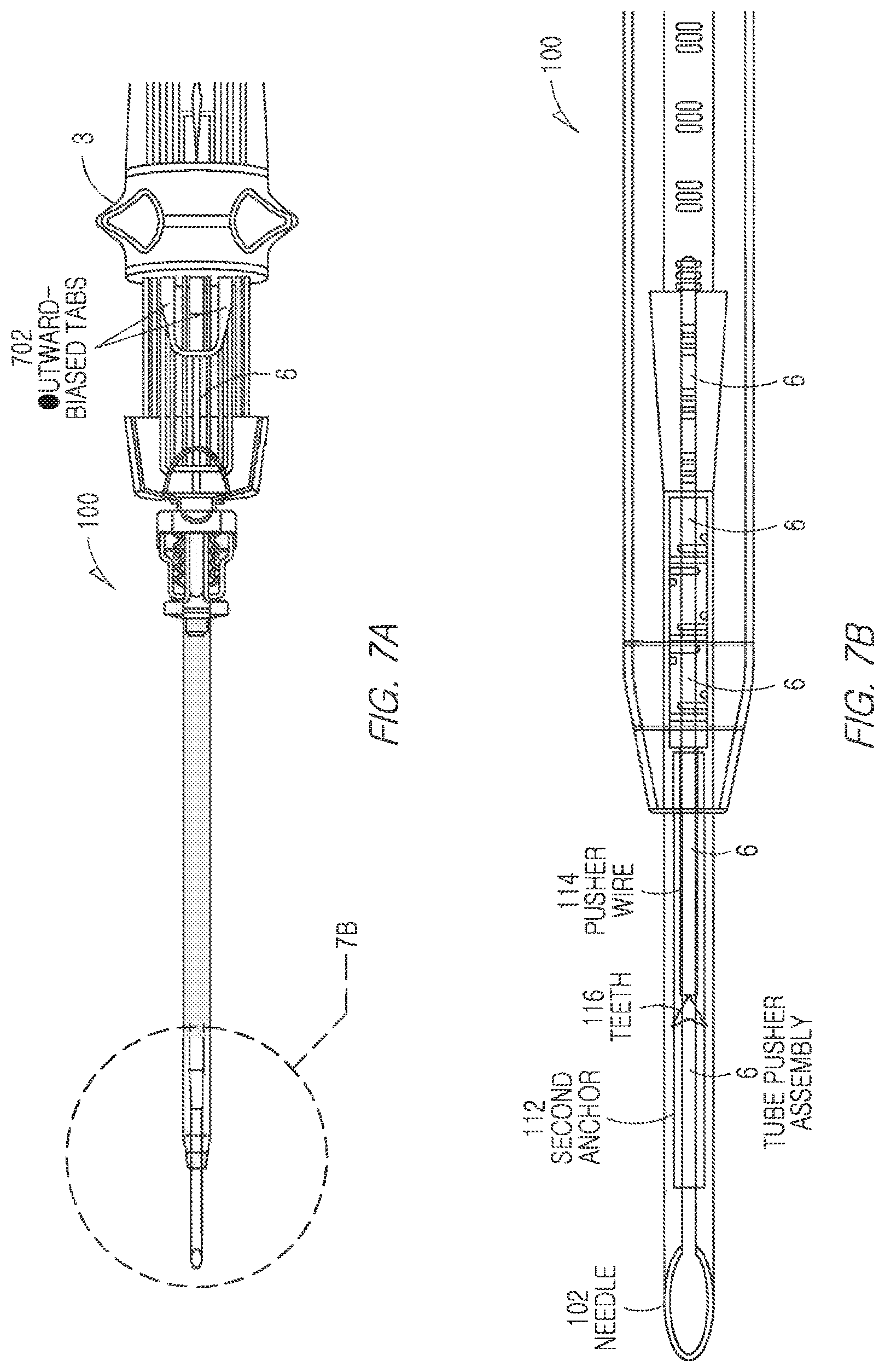 Patent US11812943 Figure 7 – Repair device and method for deploying anchors