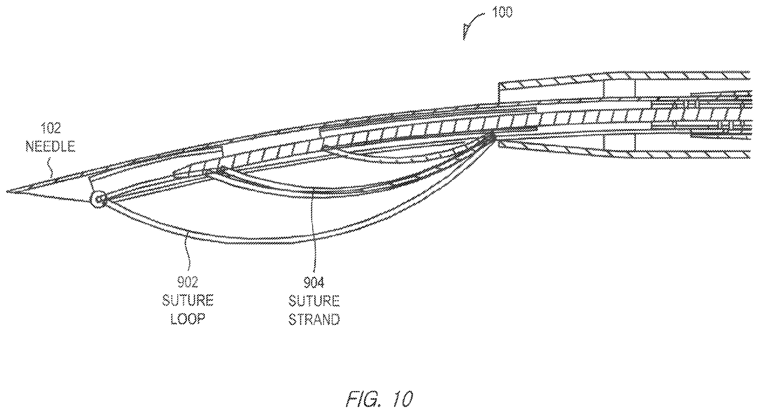 Patent US11812943 Figure 10 – Repair device and method for deploying anchors
