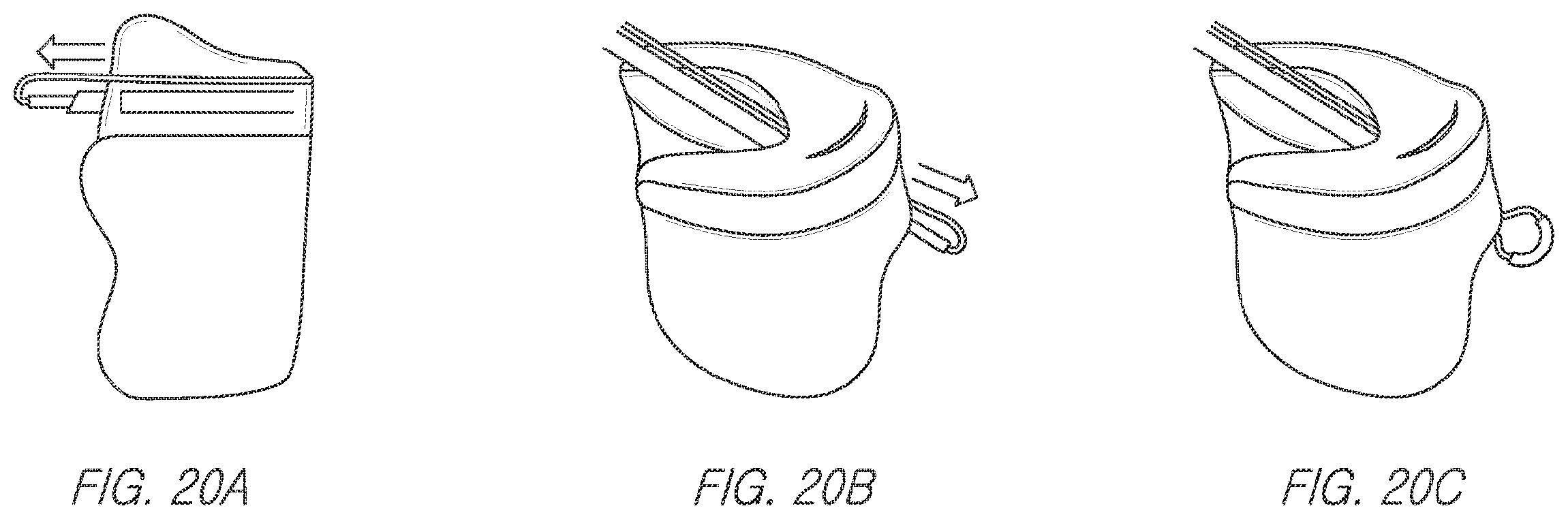 Patent US11812943 Figure 16 – Repair device and method for deploying anchors