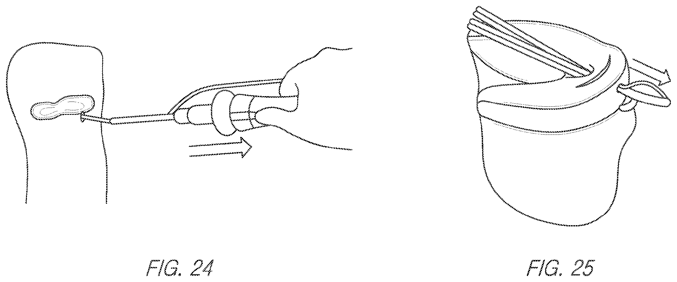 Patent US11812943 Figure 18 – Repair device and method for deploying anchors