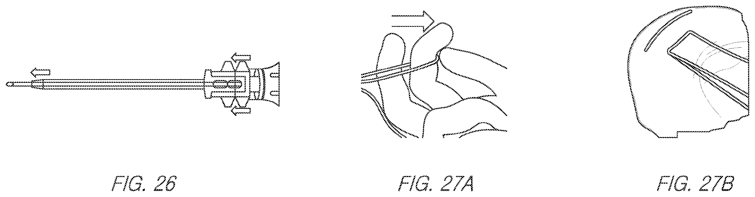 Patent US11812943 Figure 19 – Repair device and method for deploying anchors