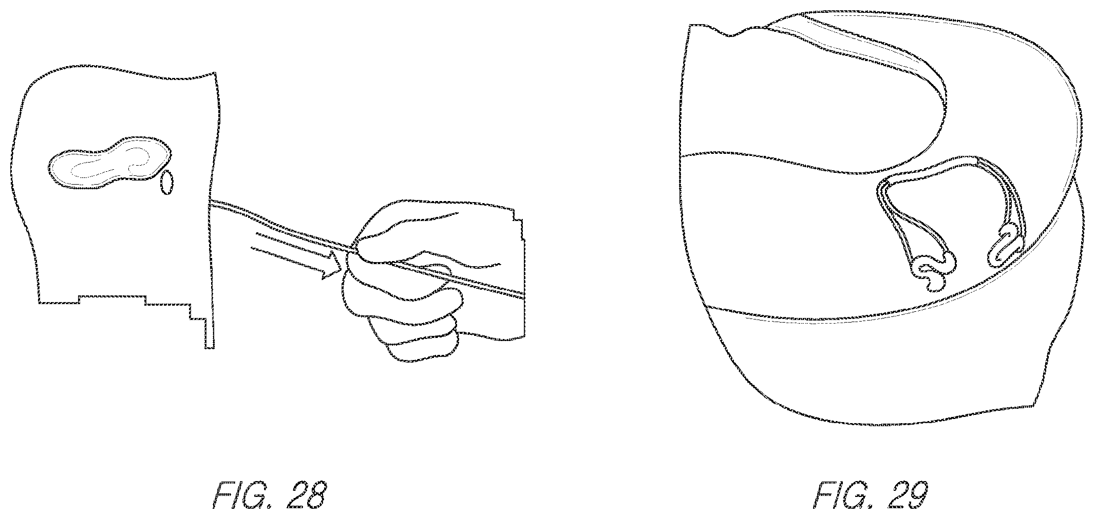 Patent US11812943 Figure 20 – Repair device and method for deploying anchors