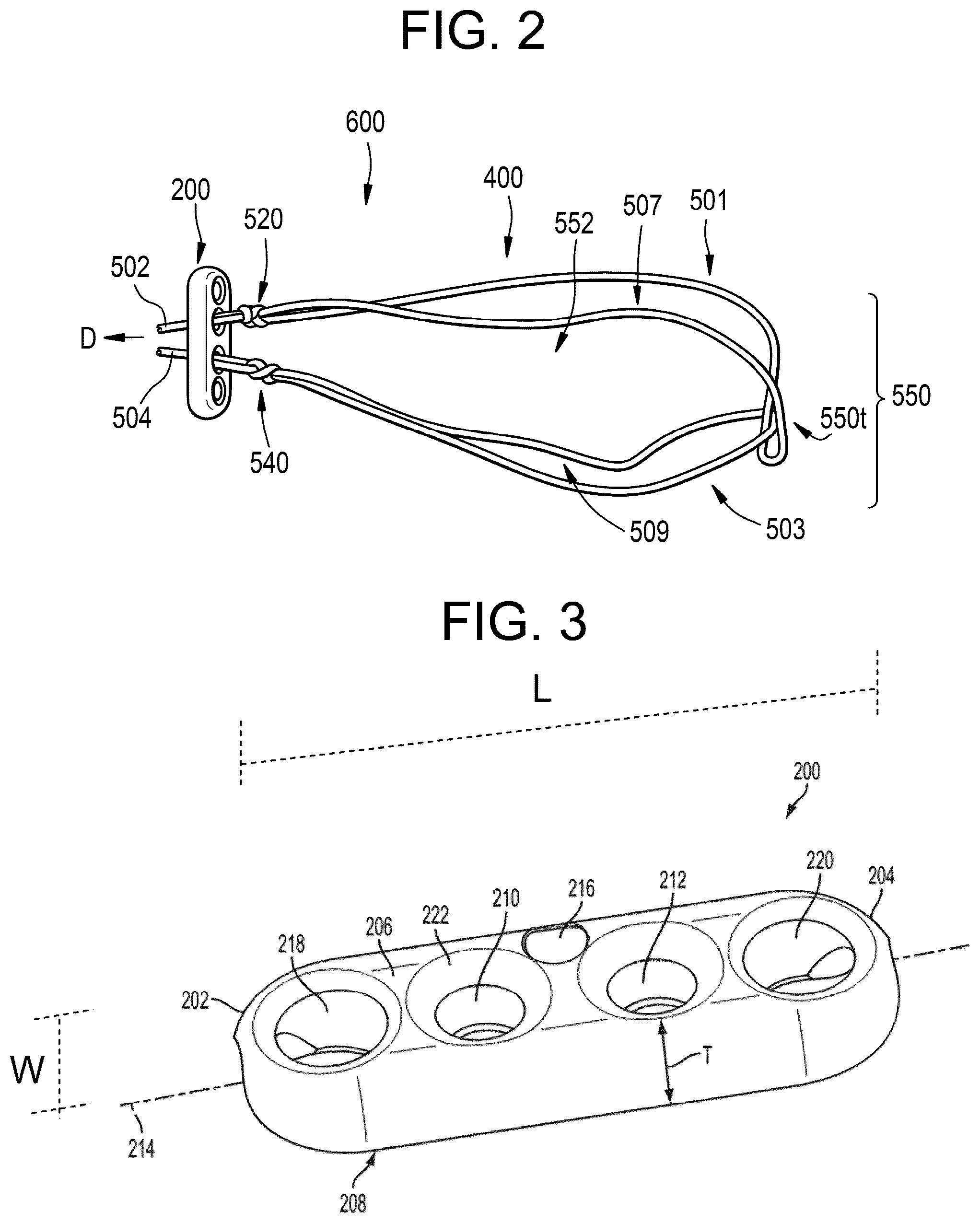 Patent US11812945 Figure 2 – One-way adjustable loop suture constructs and methods of forming and using the same