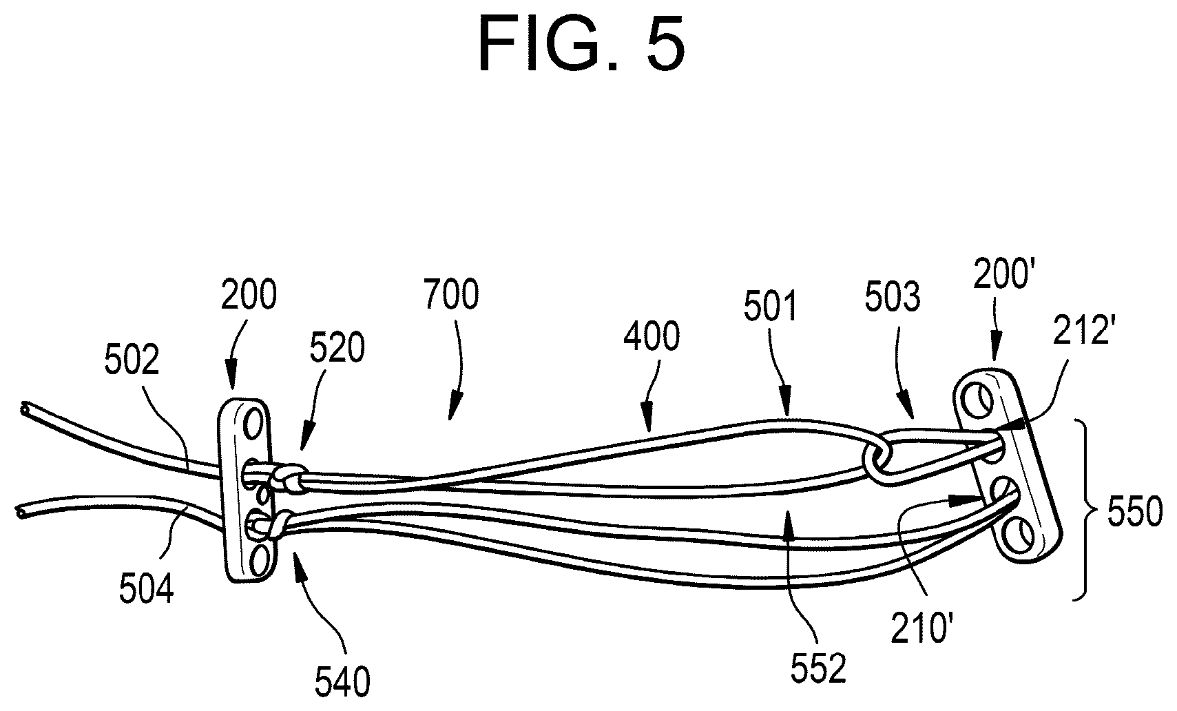 Patent US11812945 Figure 4 – One-way adjustable loop suture constructs and methods of forming and using the same
