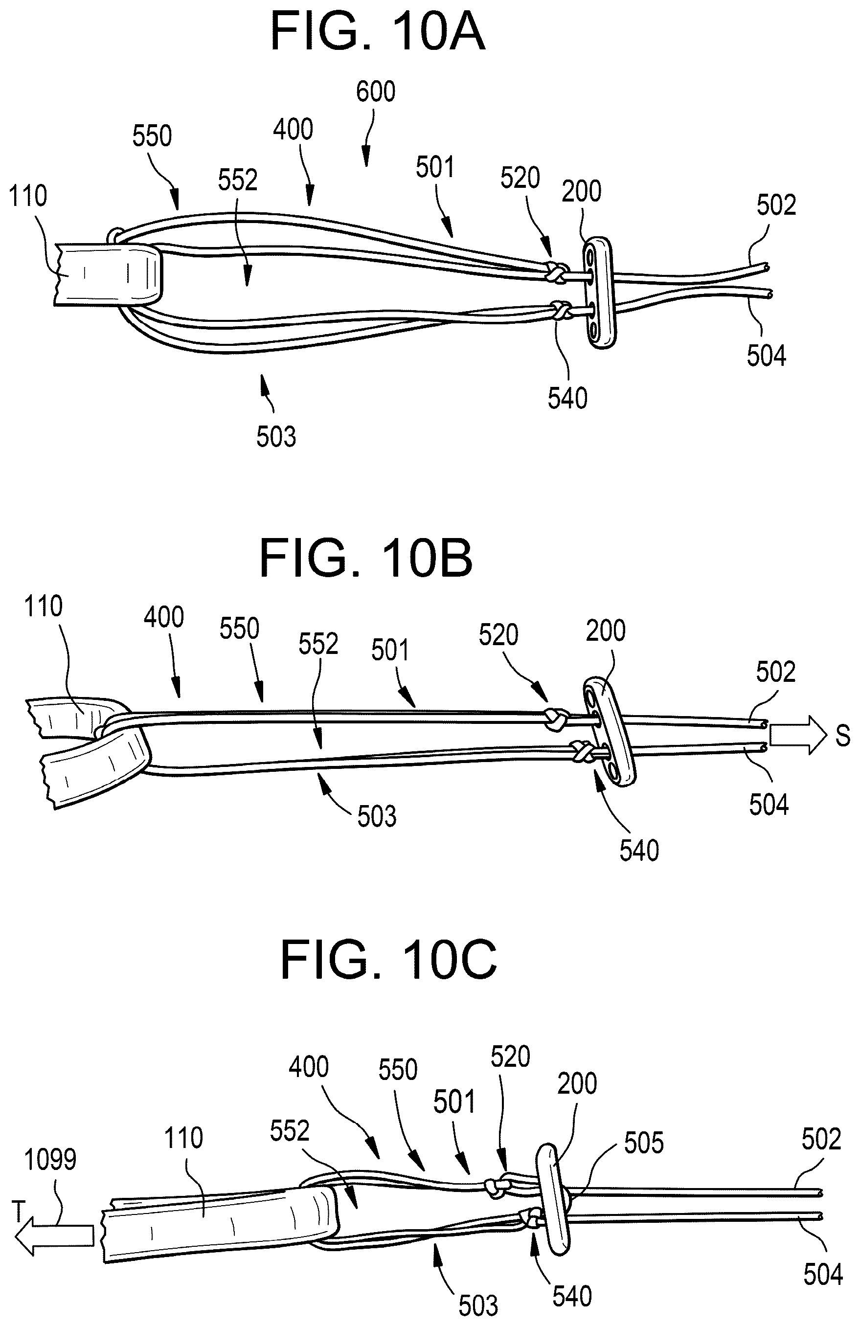 Patent US11812945 Figure 9 – One-way adjustable loop suture constructs and methods of forming and using the same