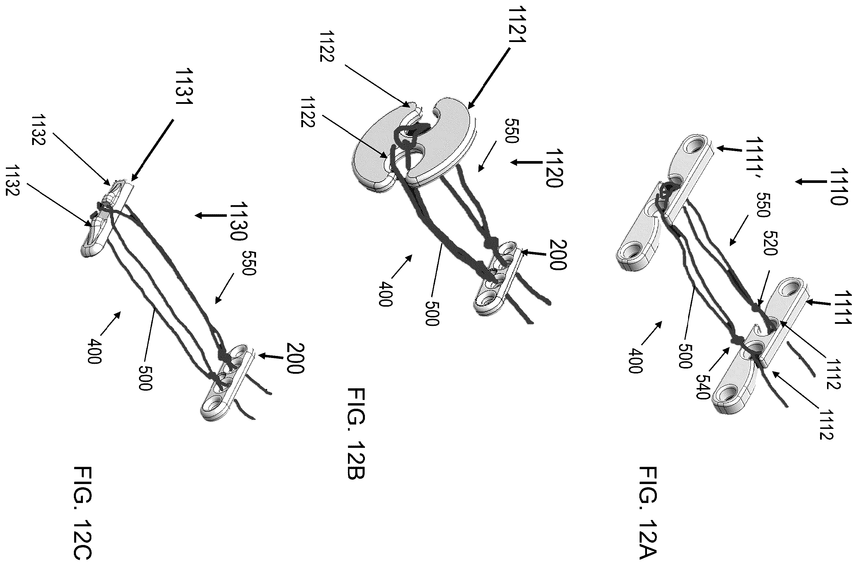 Patent US11812945 Figure 11 – One-way adjustable loop suture constructs and methods of forming and using the same