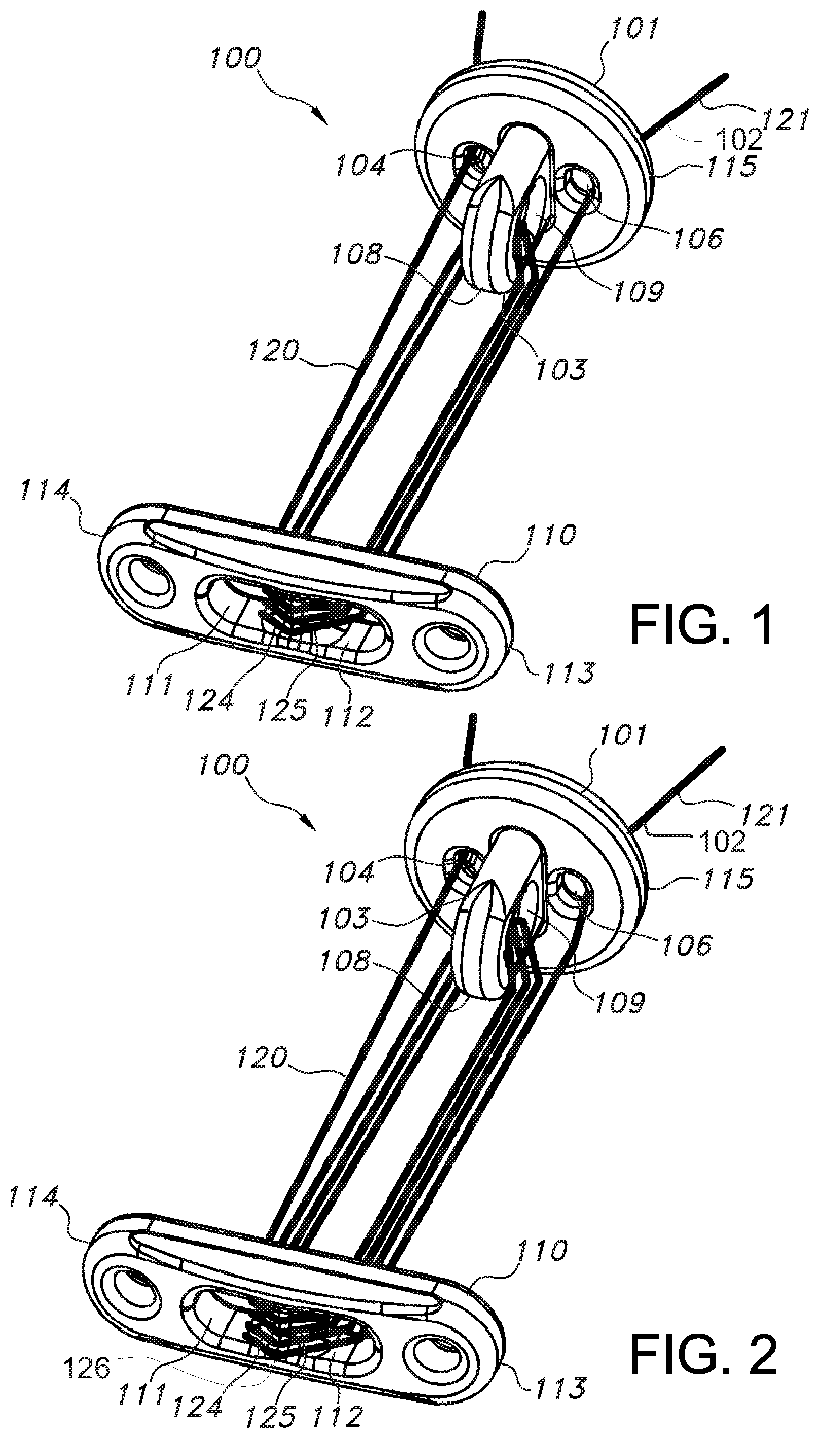 Patent US11812946 Figure 1 – Knotless orthopedic stabilization system