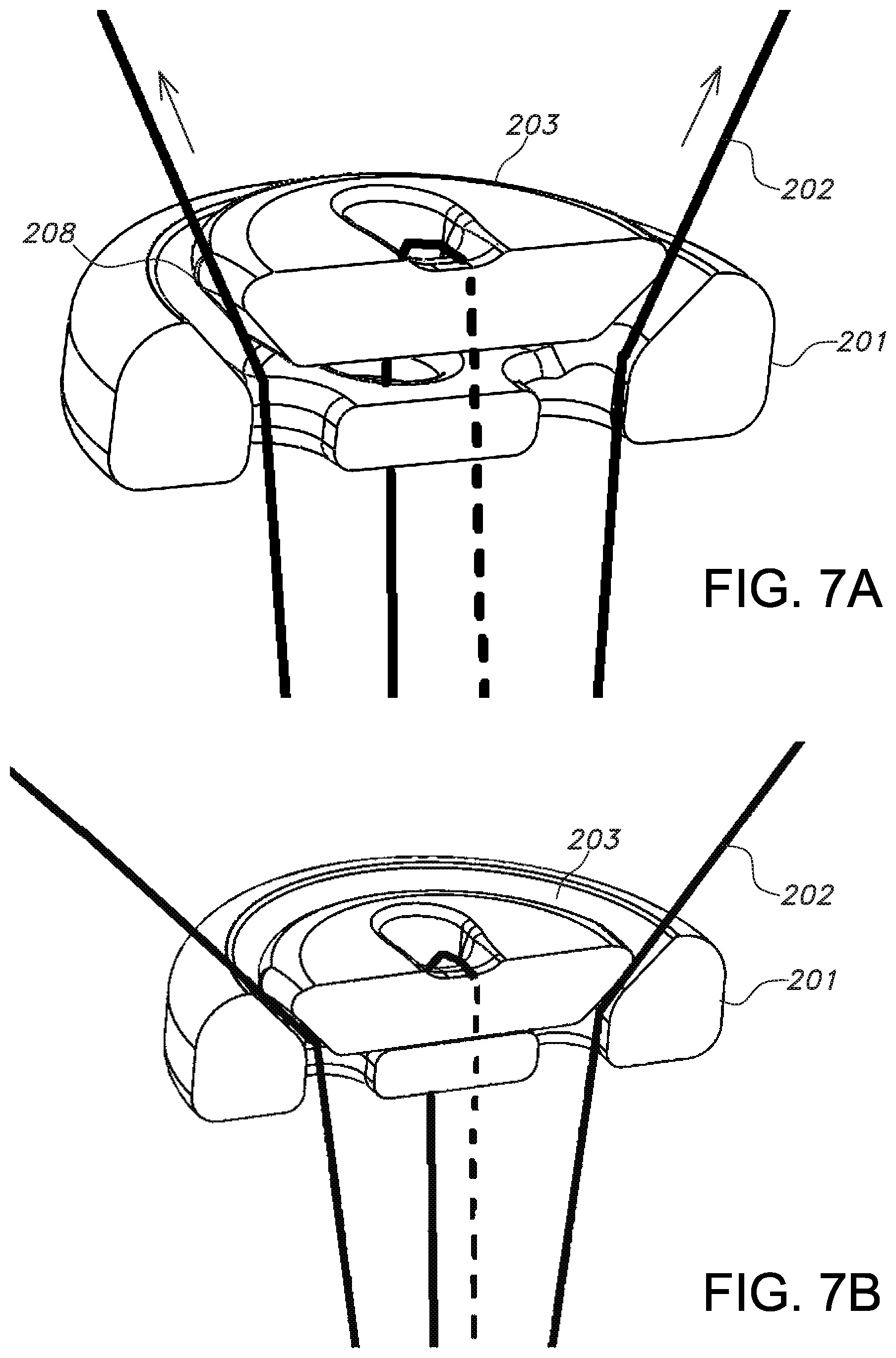 Patent US11812946 Figure 4 – Knotless orthopedic stabilization system