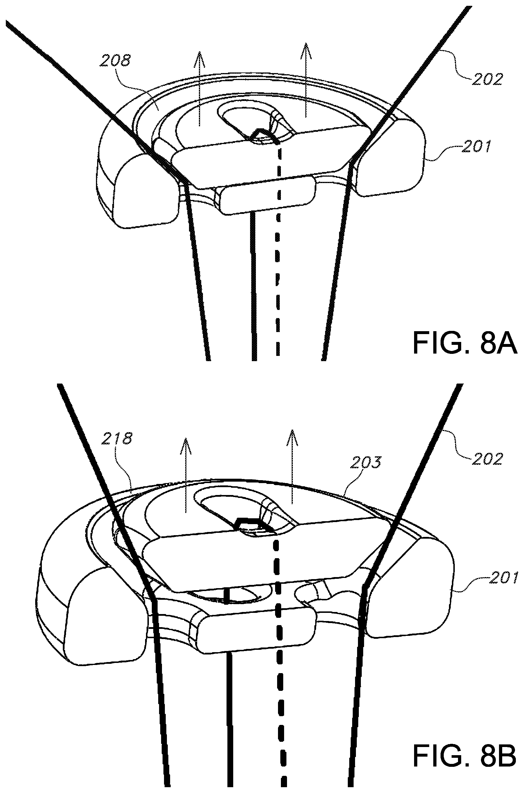 Patent US11812946 Figure 5 – Knotless orthopedic stabilization system
