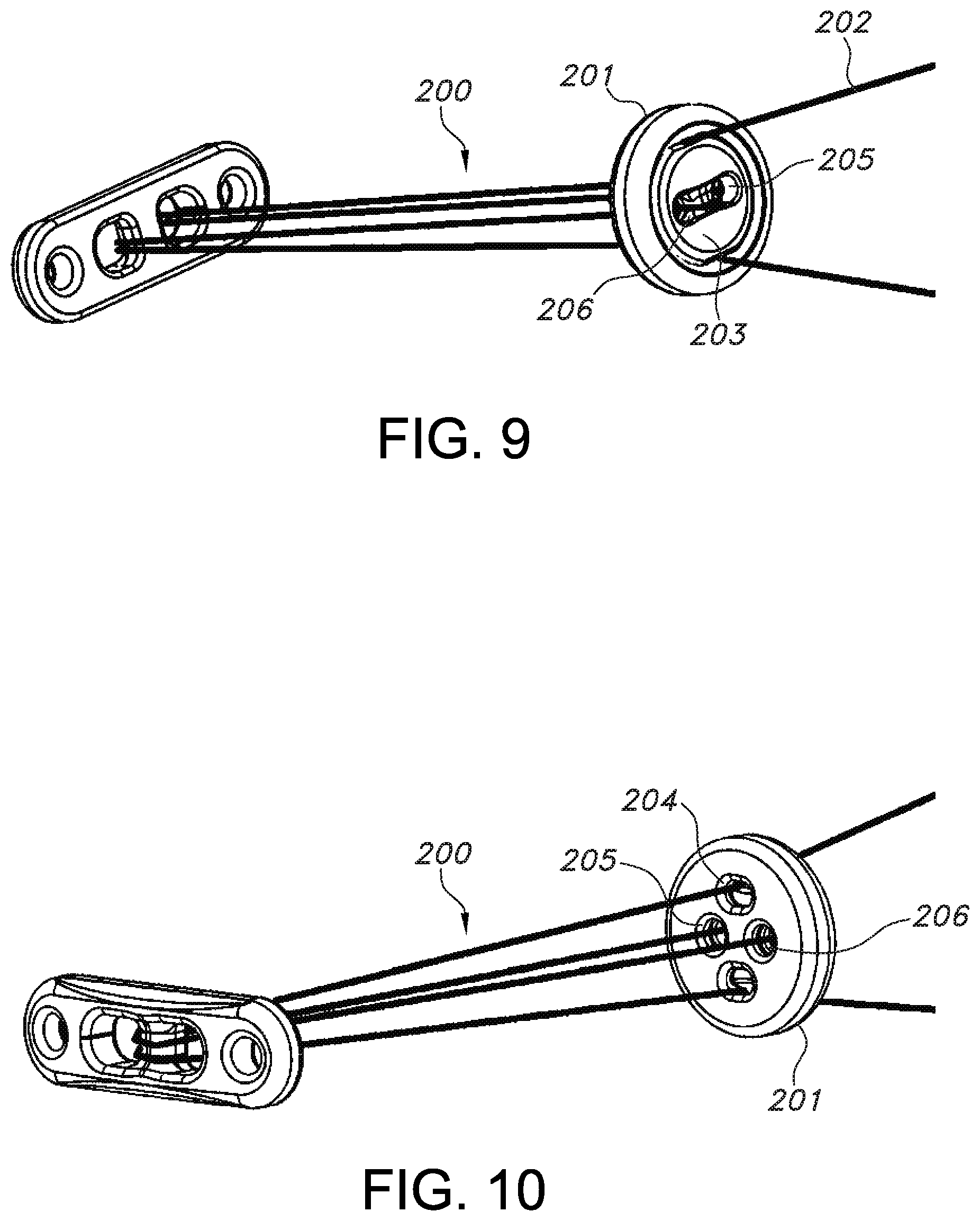 Patent US11812946 Figure 6 – Knotless orthopedic stabilization system