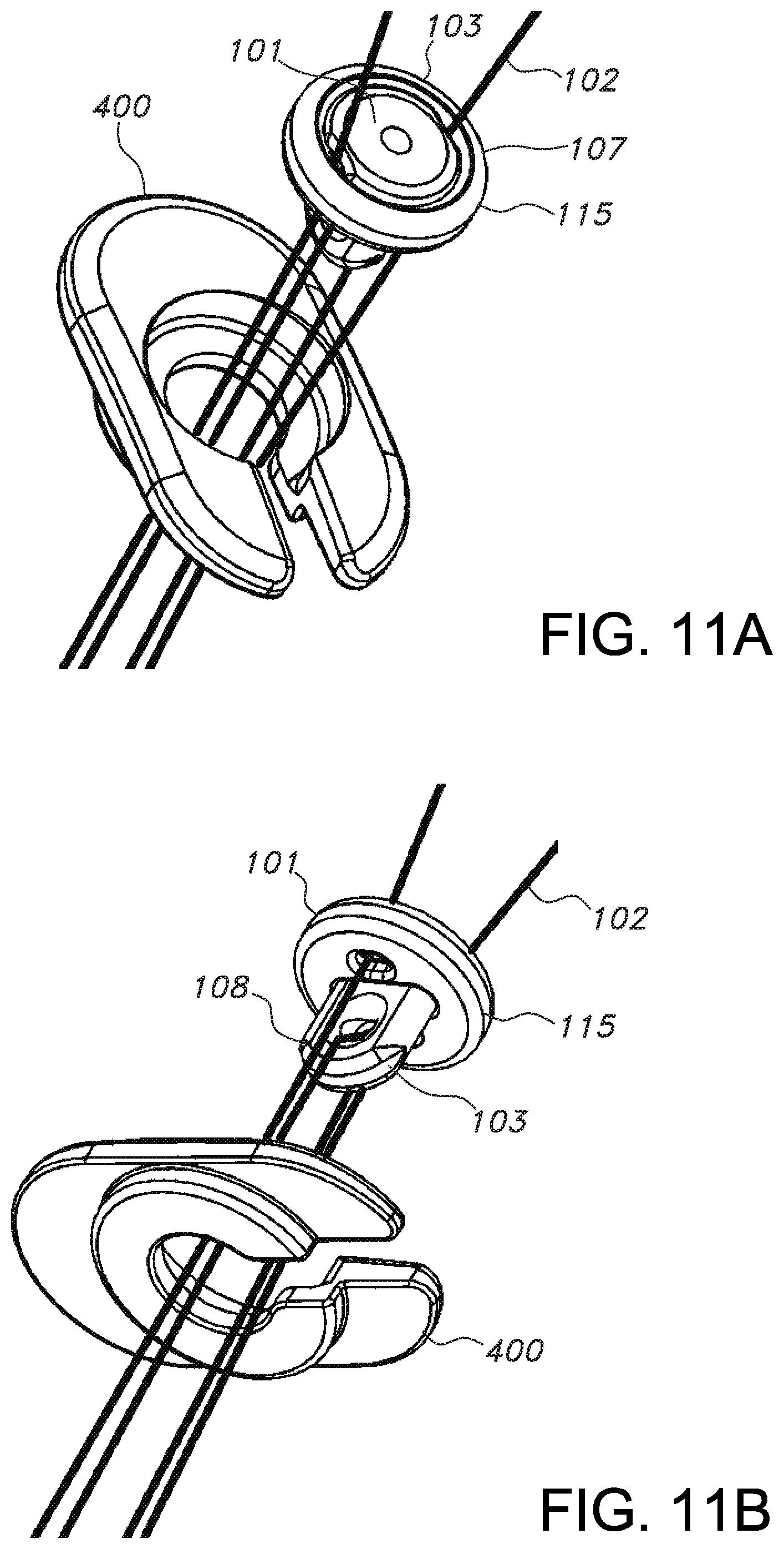 Patent US11812946 Figure 7 – Knotless orthopedic stabilization system