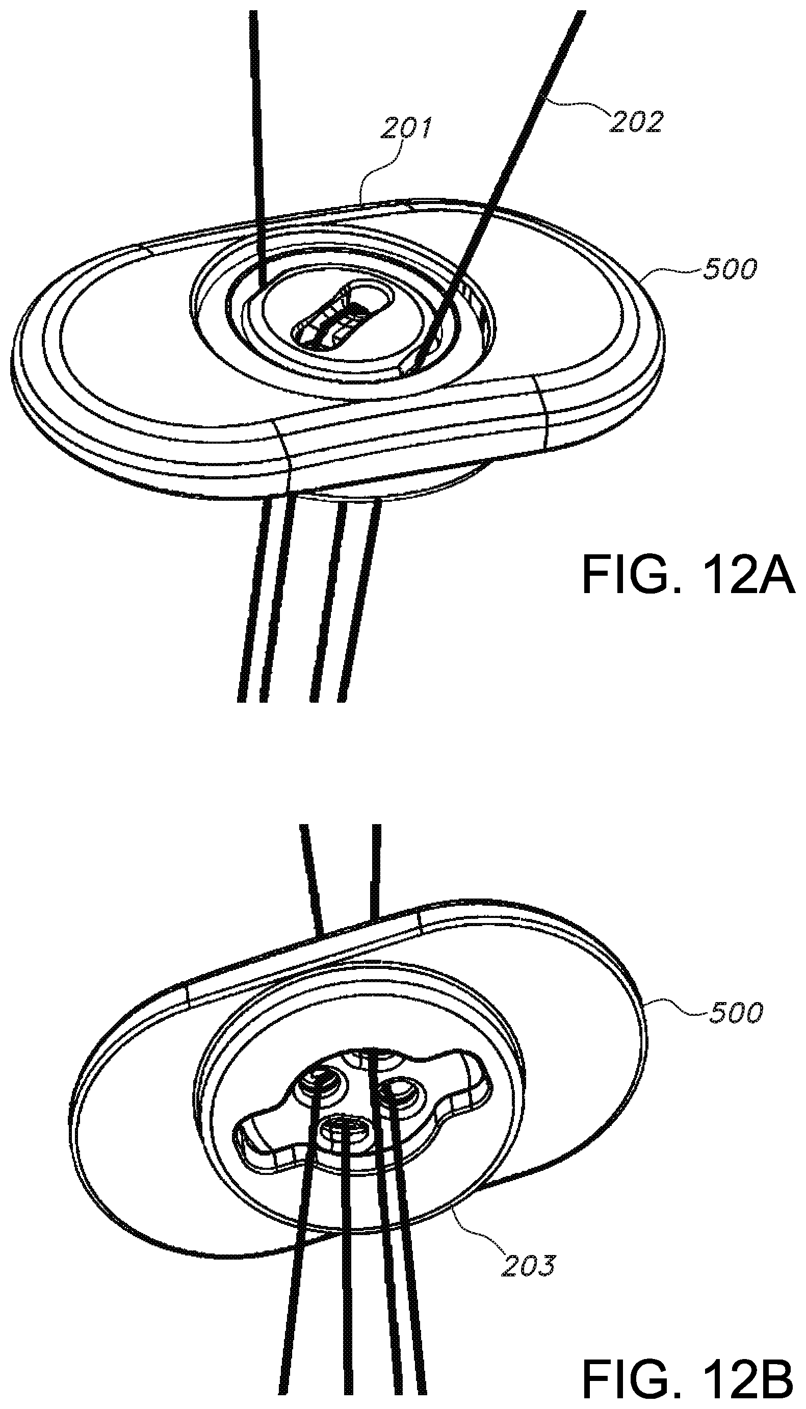 Patent US11812946 Figure 8 – Knotless orthopedic stabilization system