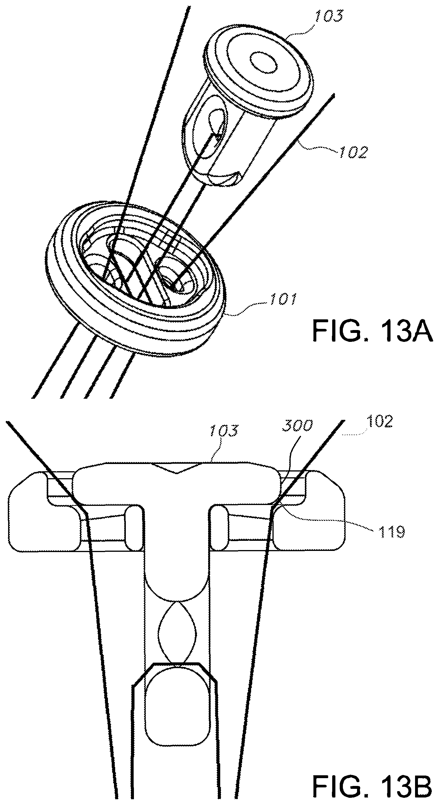 Patent US11812946 Figure 10 – Knotless orthopedic stabilization system