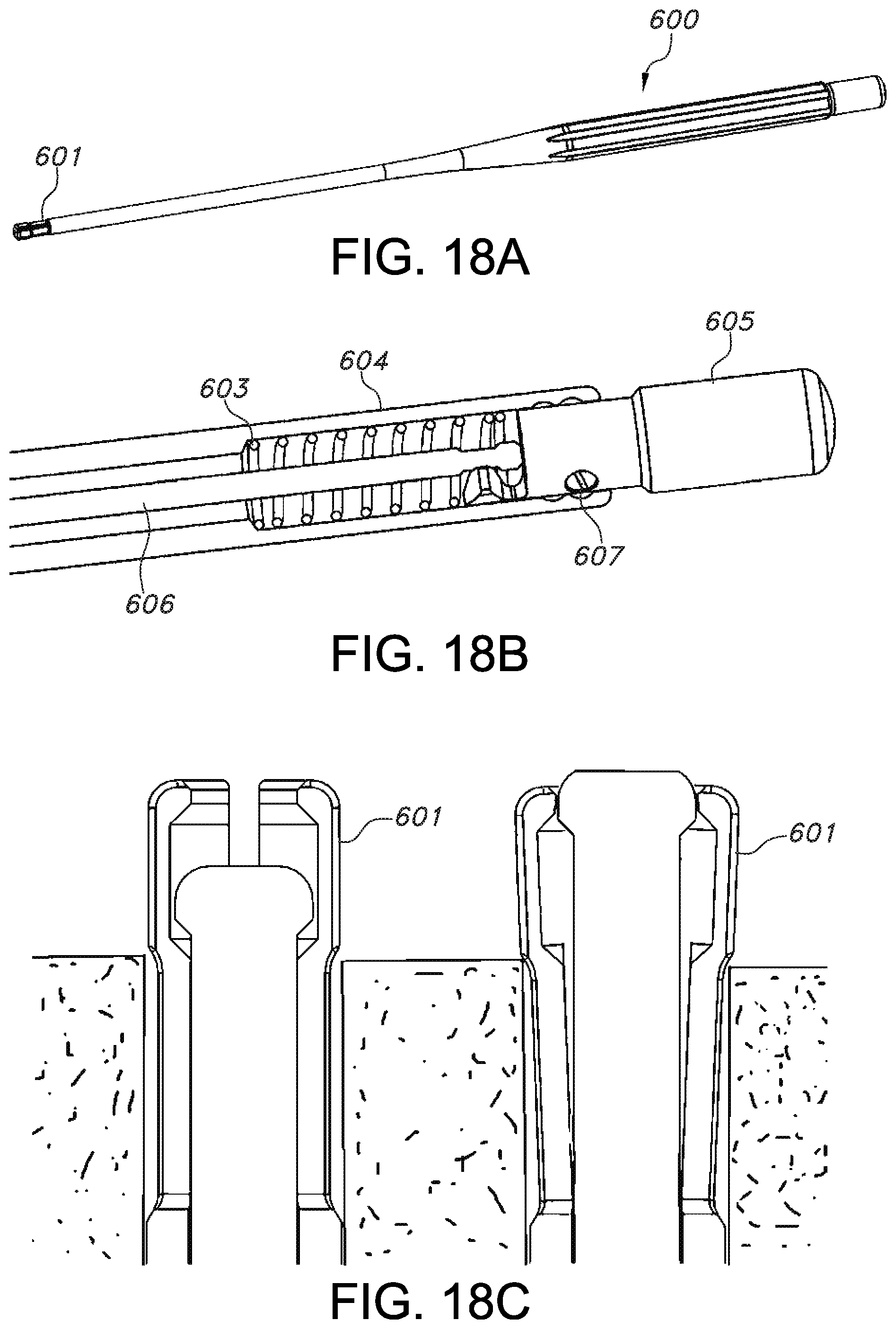 Patent US11812946 Figure 14 – Knotless orthopedic stabilization system
