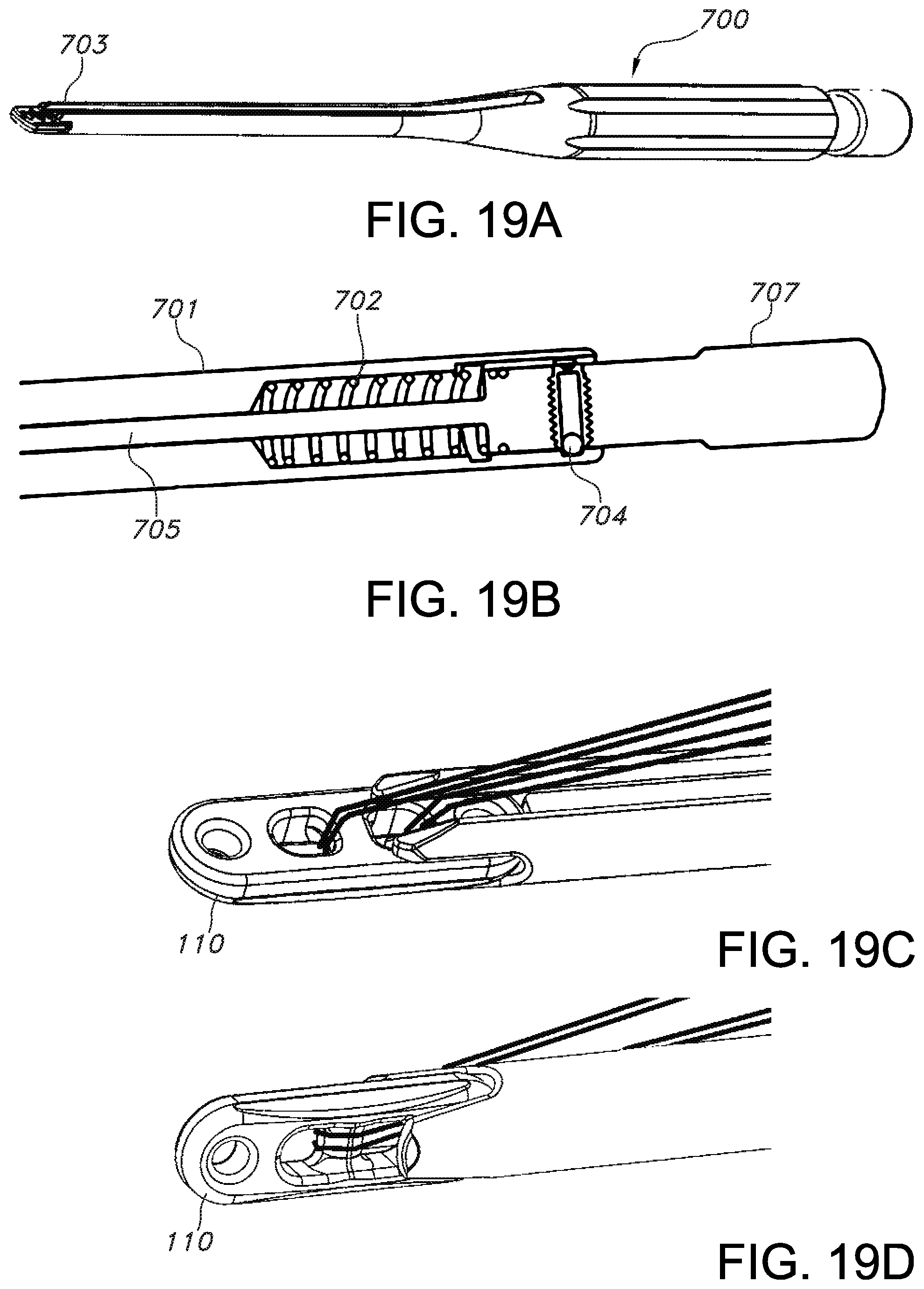 Patent US11812946 Figure 15 – Knotless orthopedic stabilization system