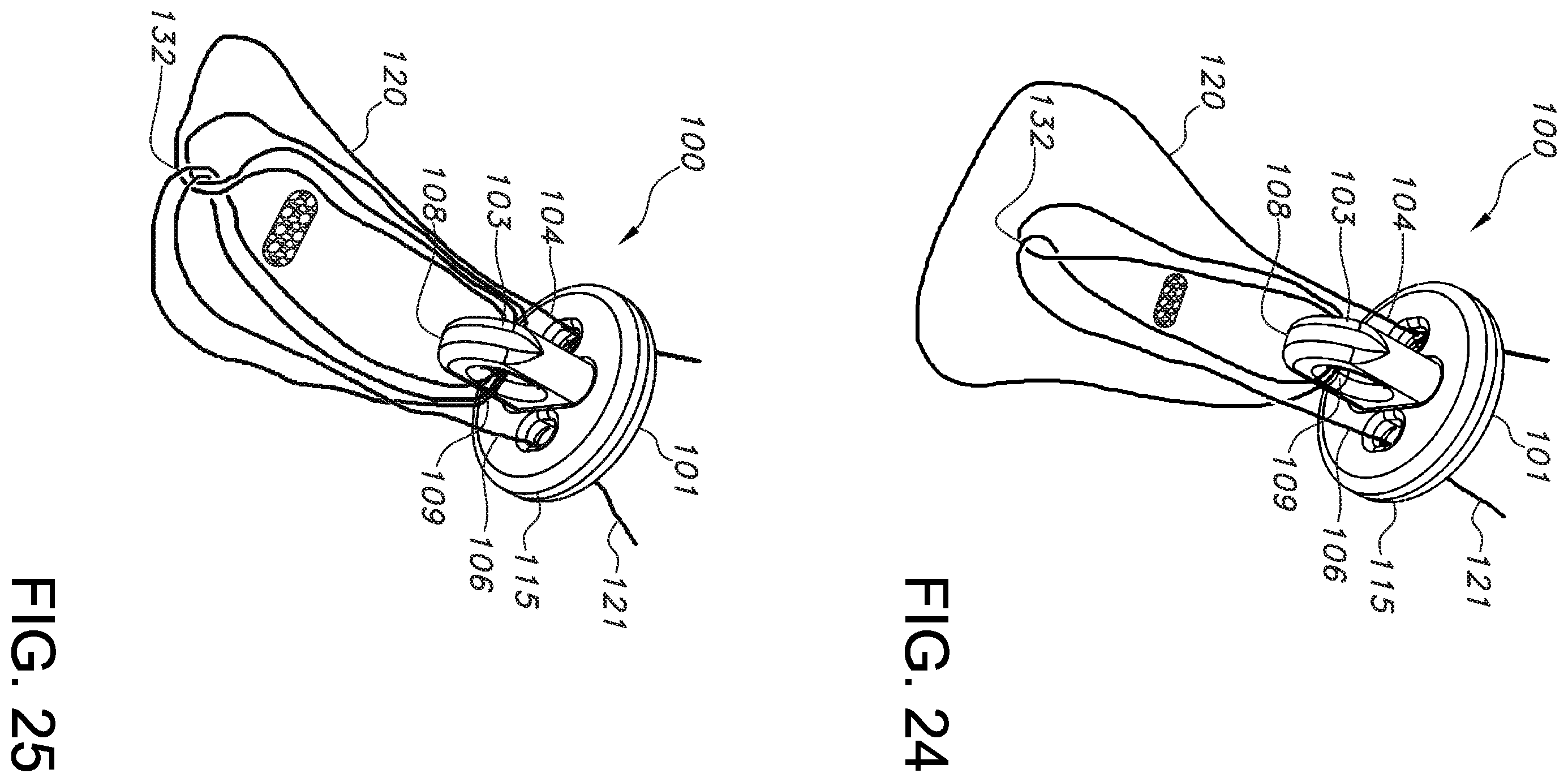 Patent US11812946 Figure 19 – Knotless orthopedic stabilization system