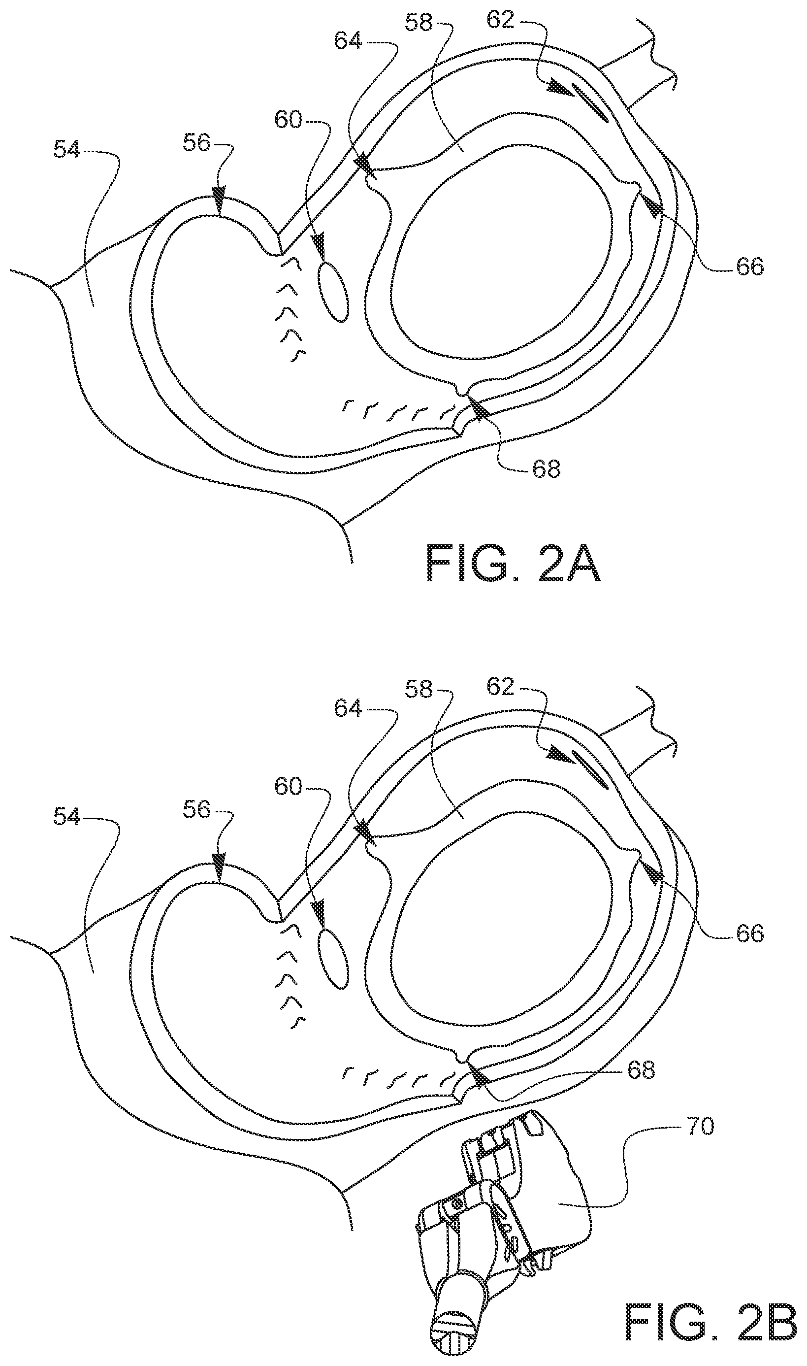 Patent US11812947 Figure 8 – Apparatus for suture management and methods thereof