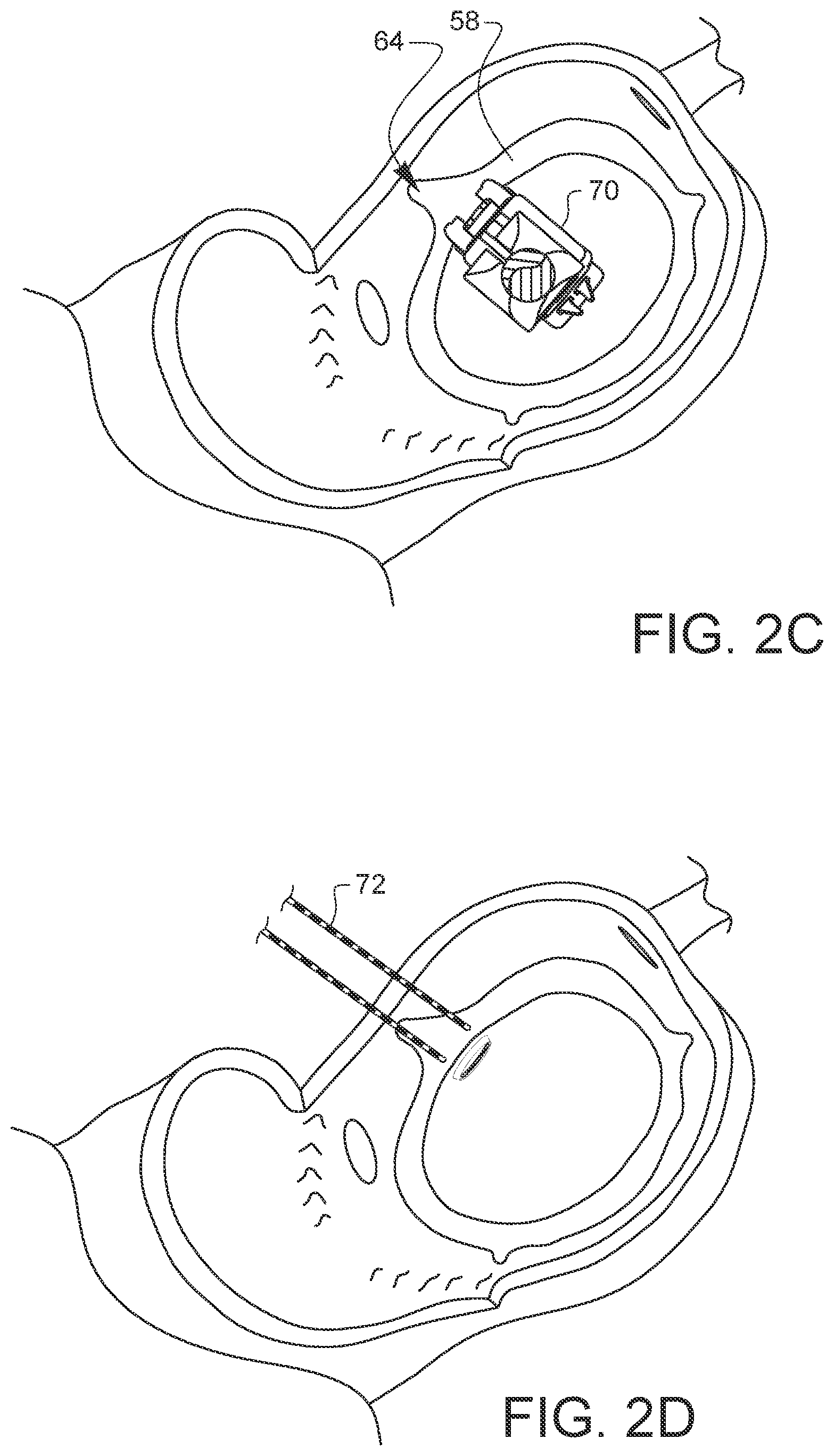 Patent US11812947 Figure 9 – Apparatus for suture management and methods thereof