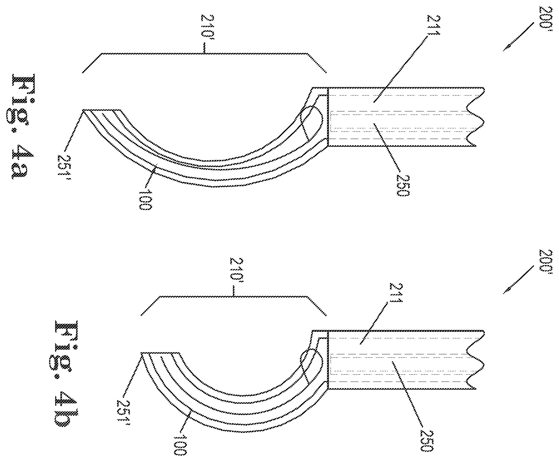 Patent US11812949 Figure 3 – Filamentous tissue implant