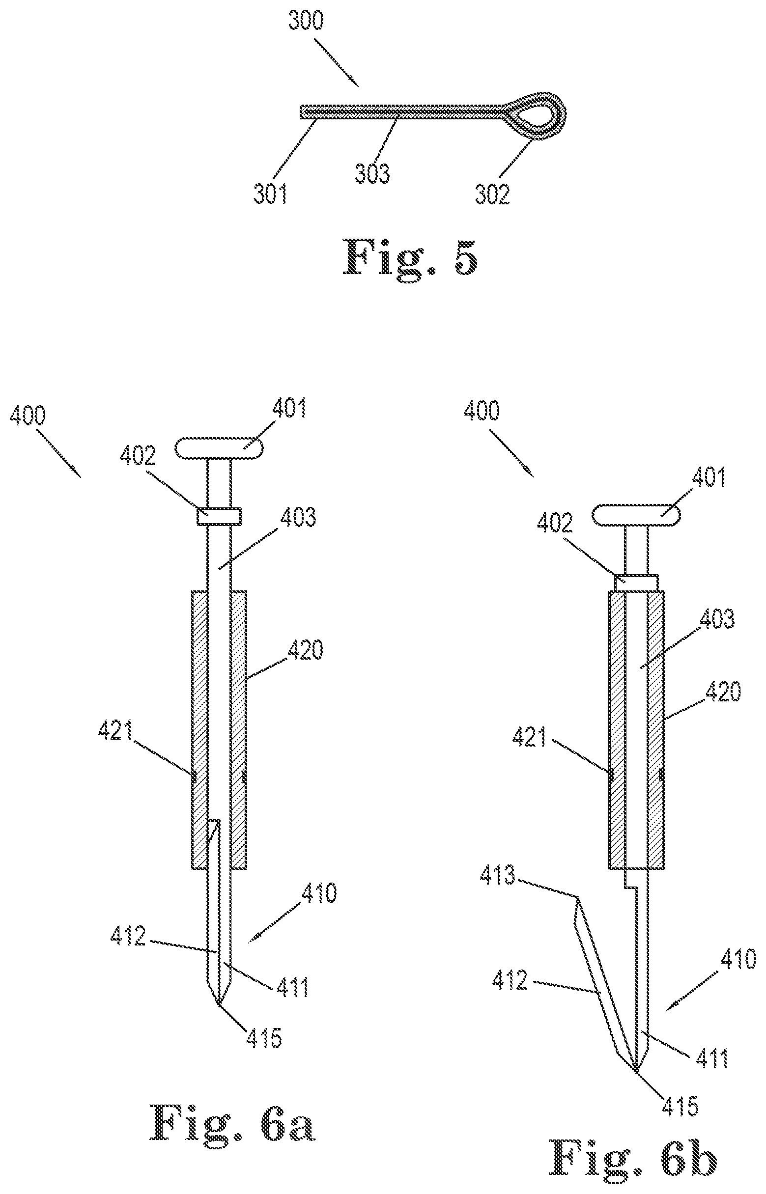 Patent US11812949 Figure 4 – Filamentous tissue implant