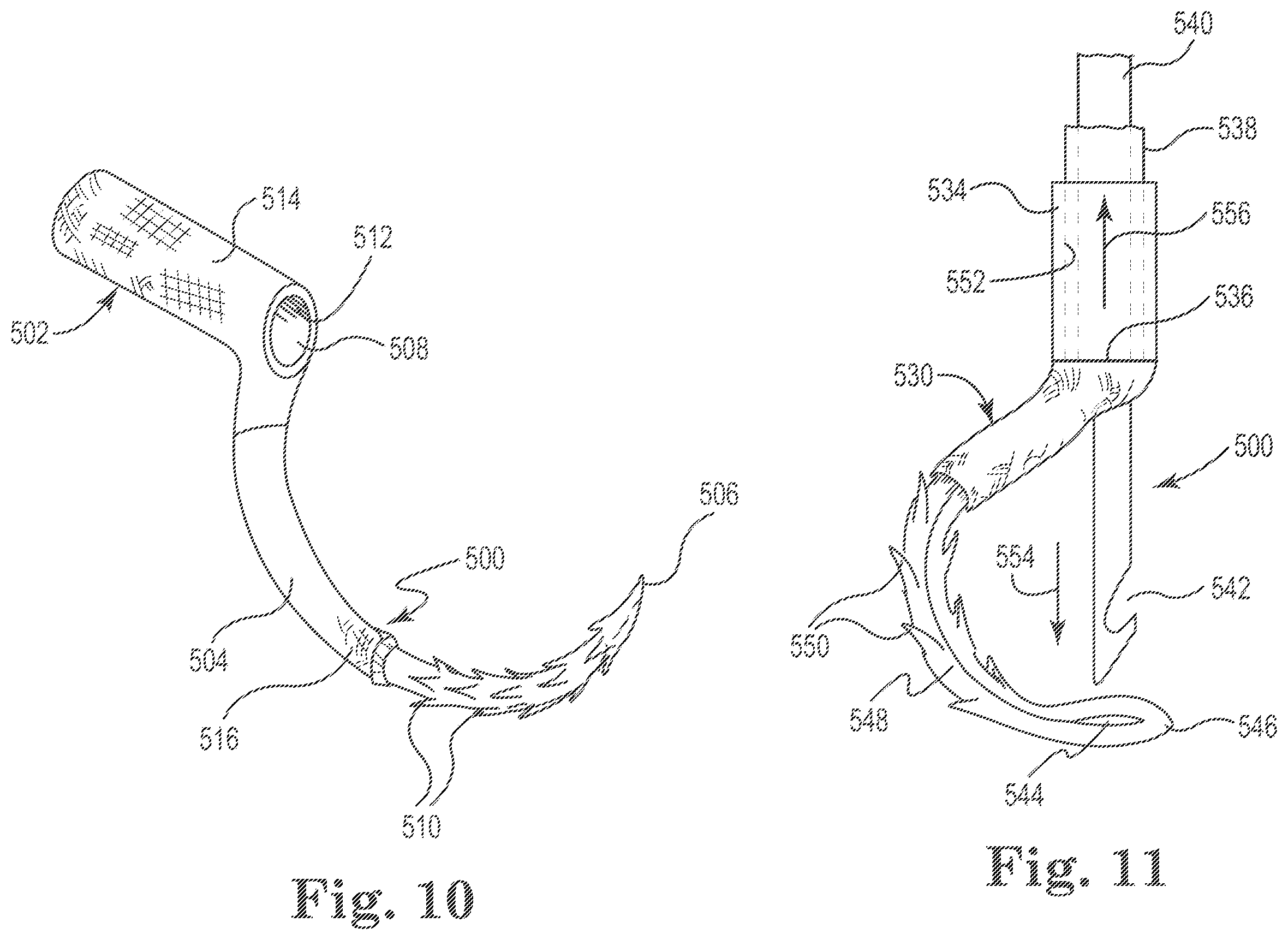 Patent US11812949 Figure 7 – Filamentous tissue implant