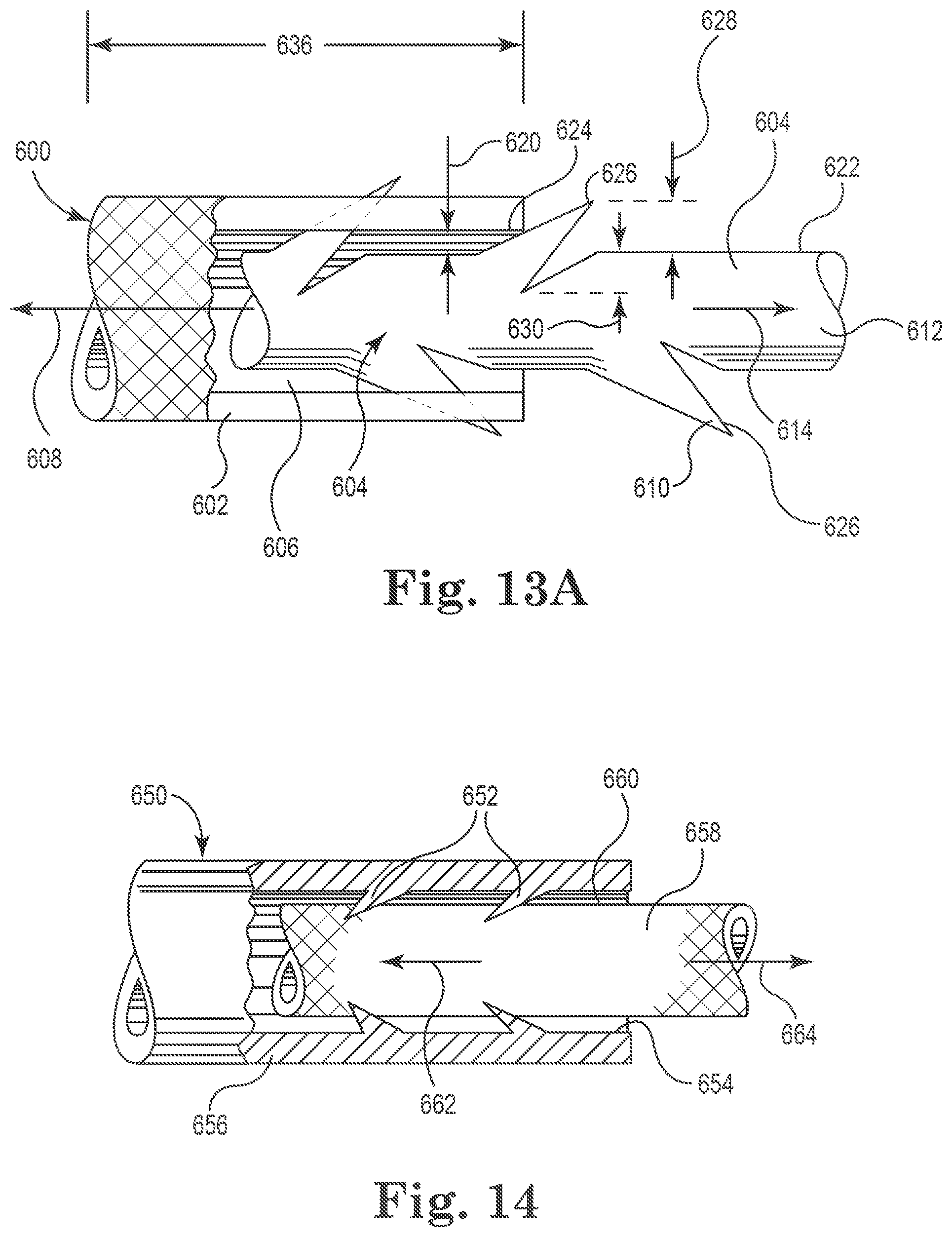 Patent US11812949 Figure 10 – Filamentous tissue implant