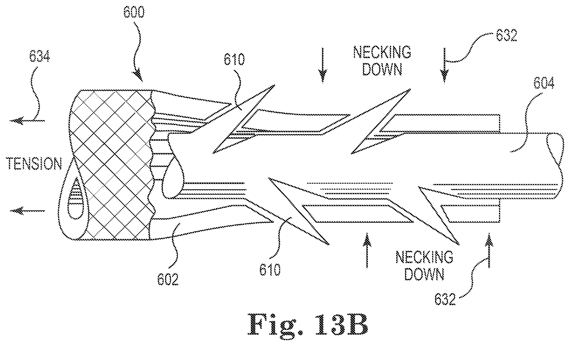 Patent US11812949 Figure 11 – Filamentous tissue implant