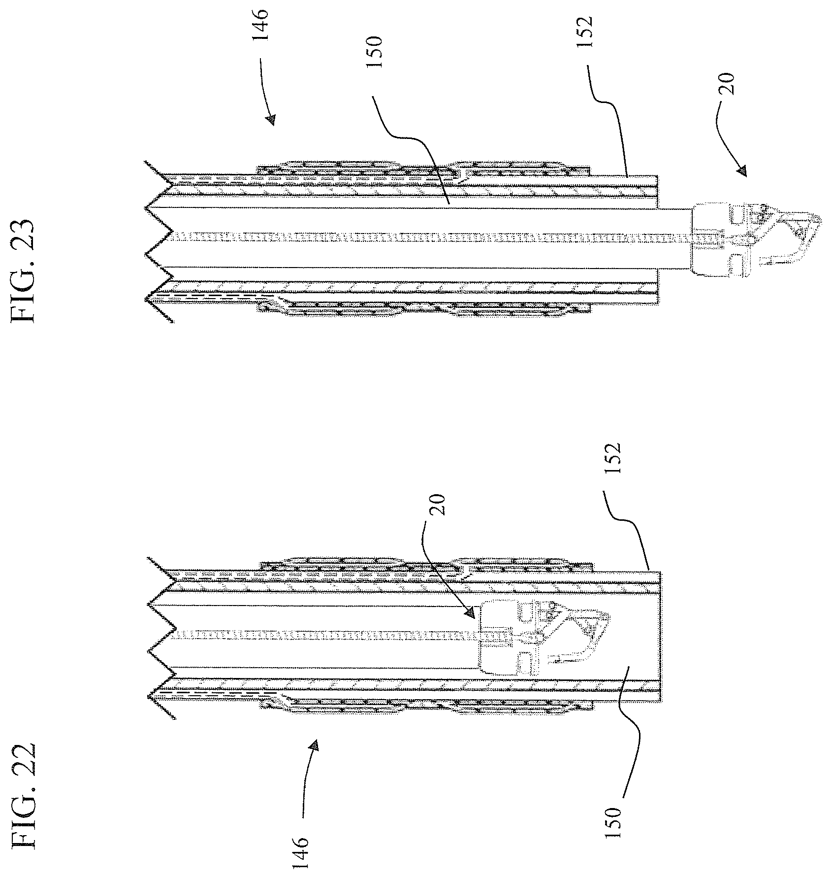 Patent US11812951 Figure 13 – Endoscopic needle assembly