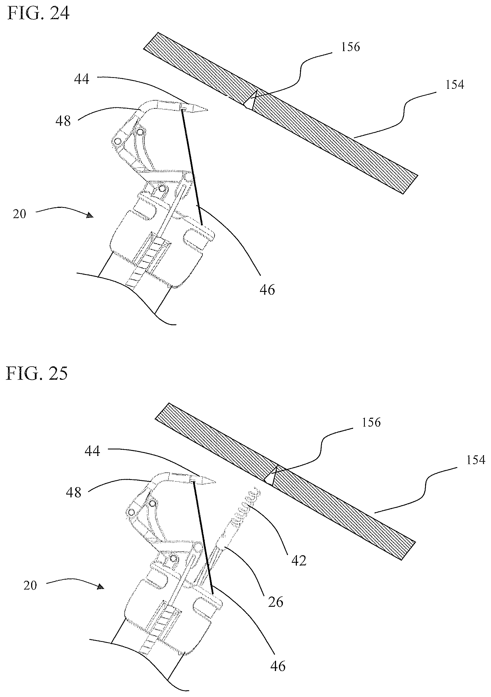 Patent US11812951 Figure 14 – Endoscopic needle assembly