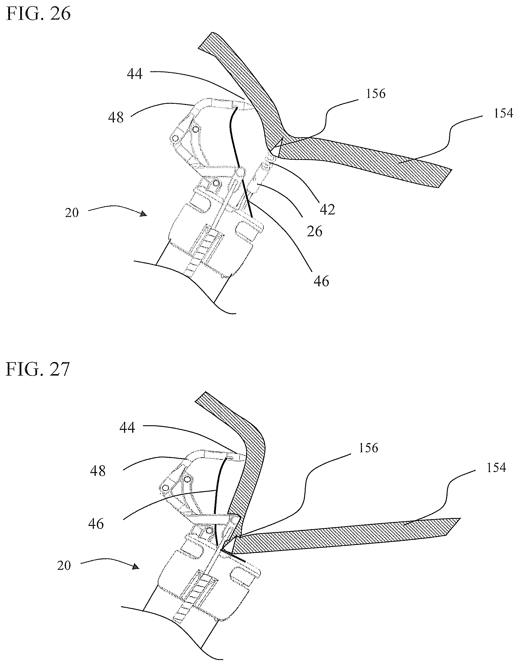 Patent US11812951 Figure 15 – Endoscopic needle assembly