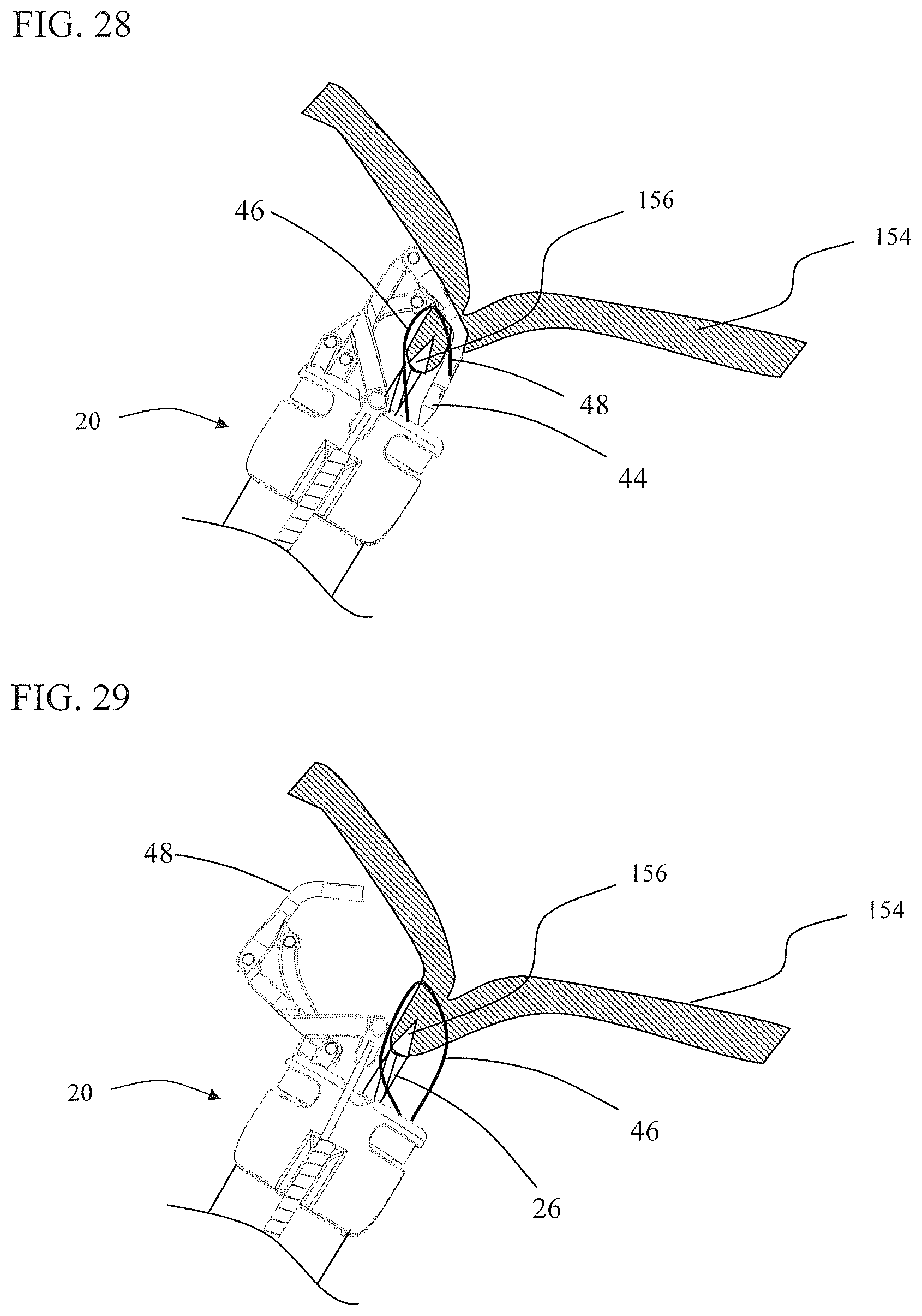 Patent US11812951 Figure 16 – Endoscopic needle assembly